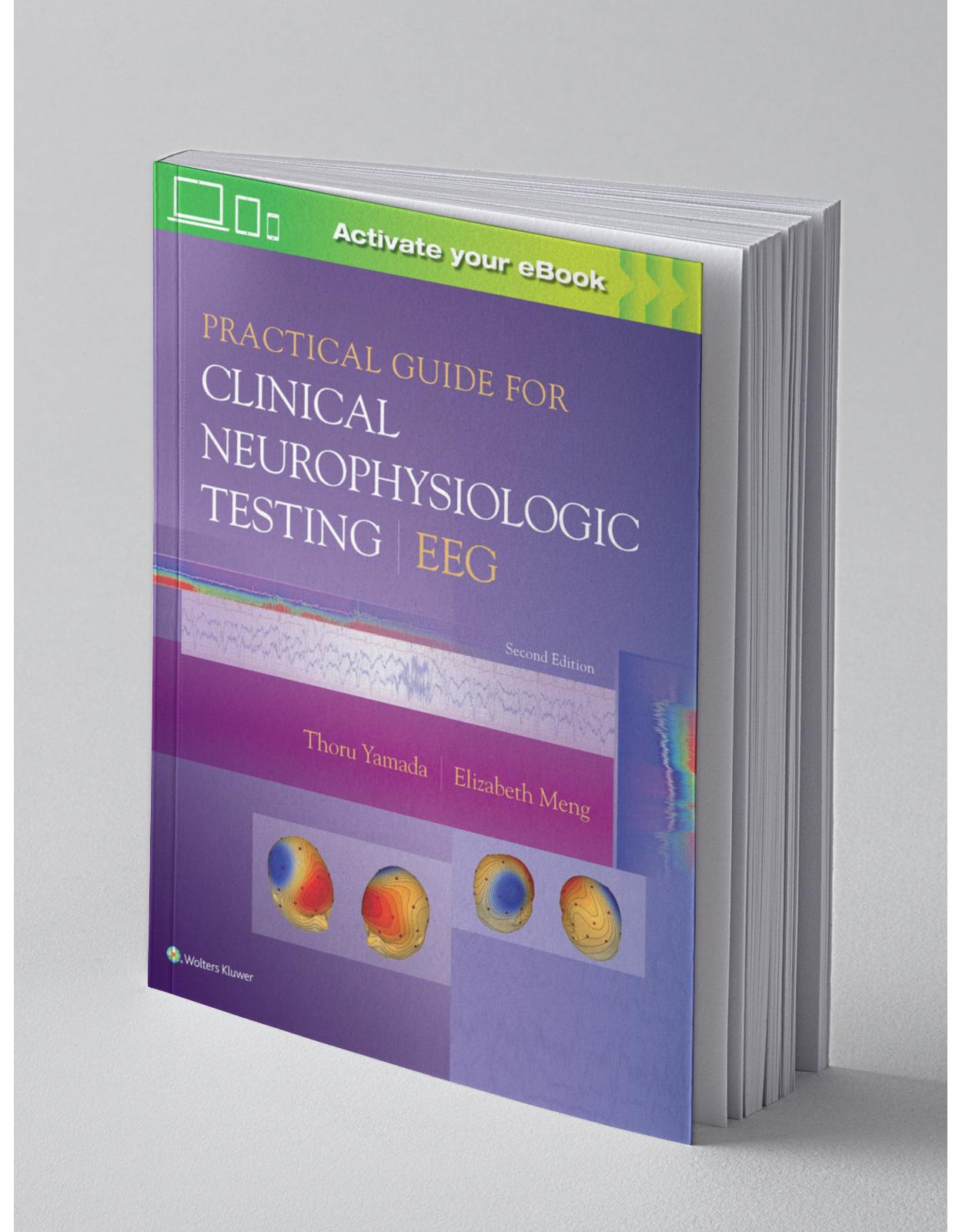 Practical Guide for Clinical Neurophysiologic Testing: EEG