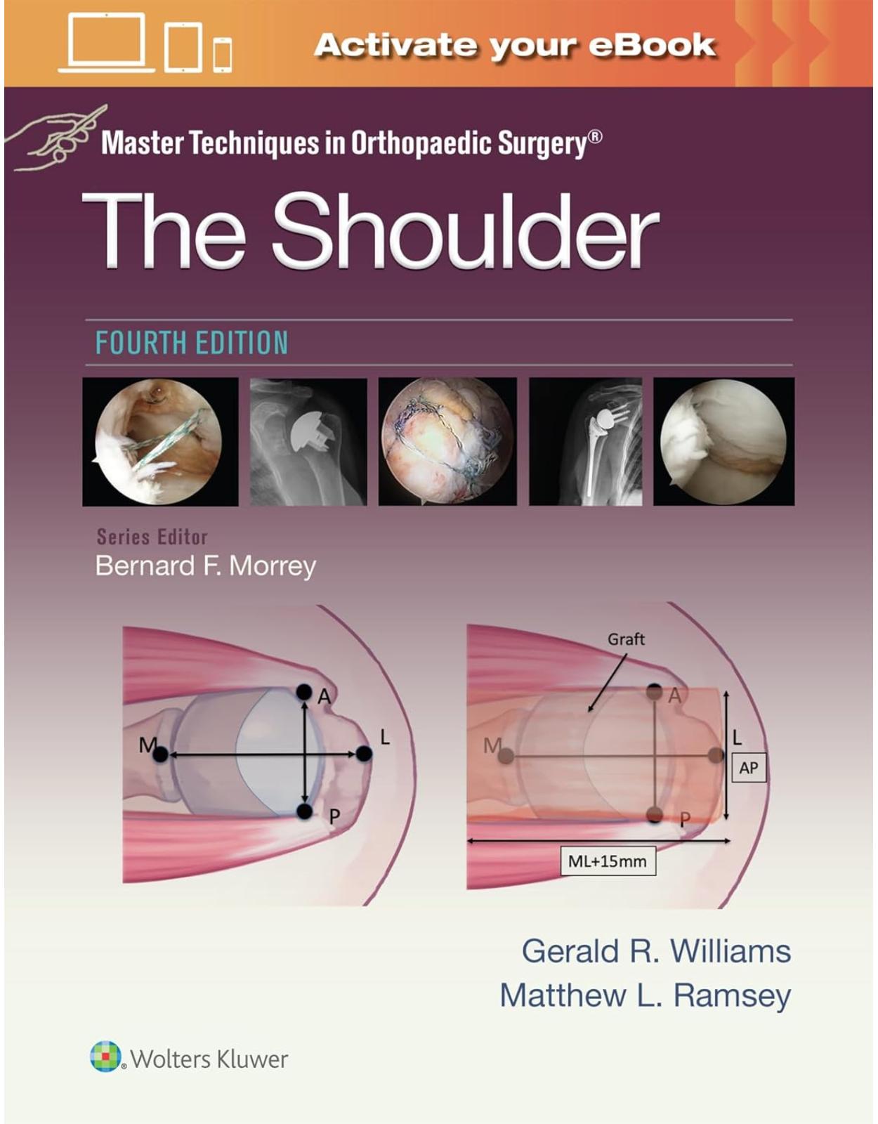 Master Techniques in Orthopaedic Surgery
