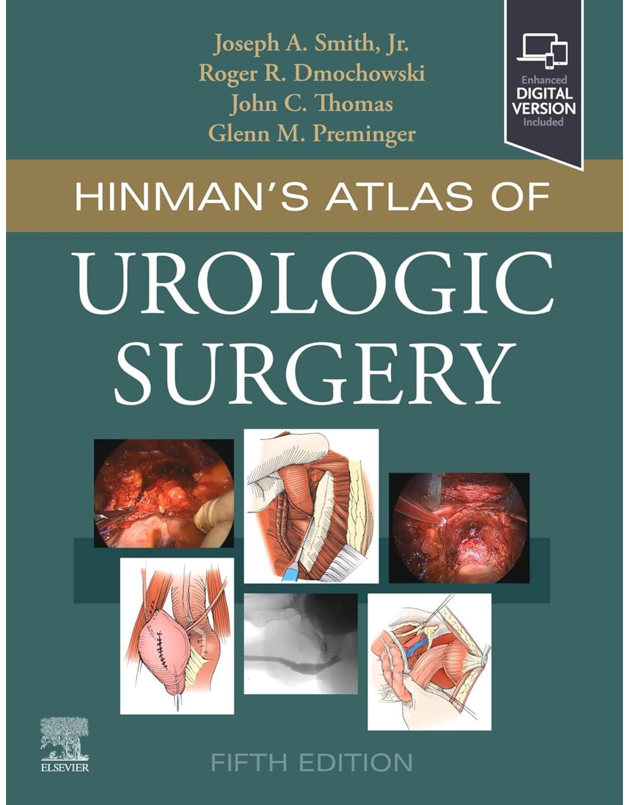 Hinmans Atlas of Urologic Surgery