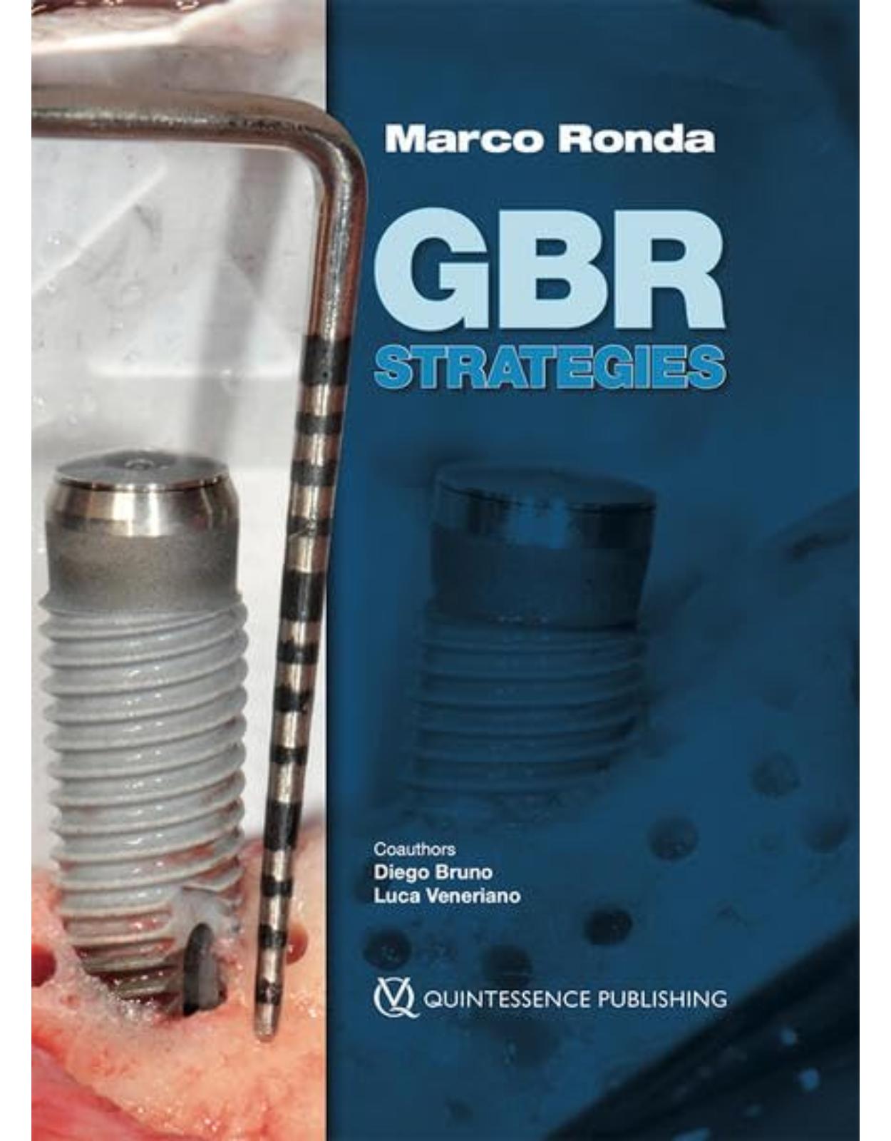 GBR Strategies