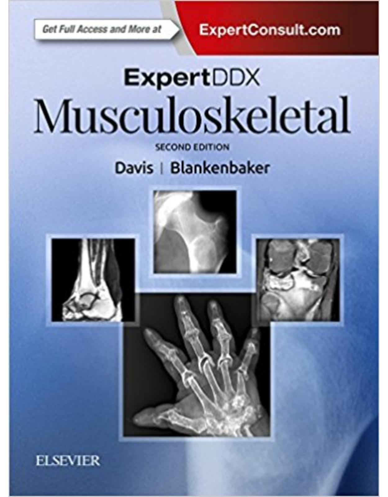 ExpertDDx: Musculoskeletal, 2nd Edition