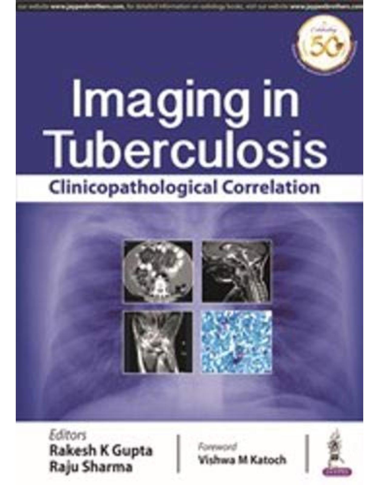 Imaging in Tuberculosis