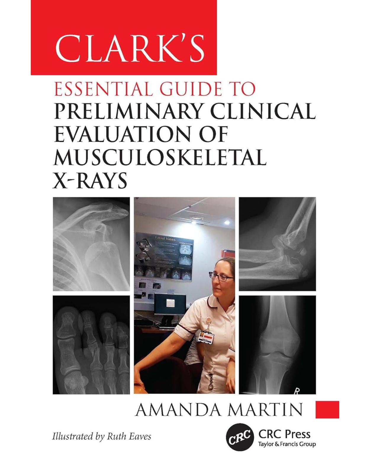 Clarks Essential Guide to Preliminary Clinical Evaluation of Musculoskeletal X-rays