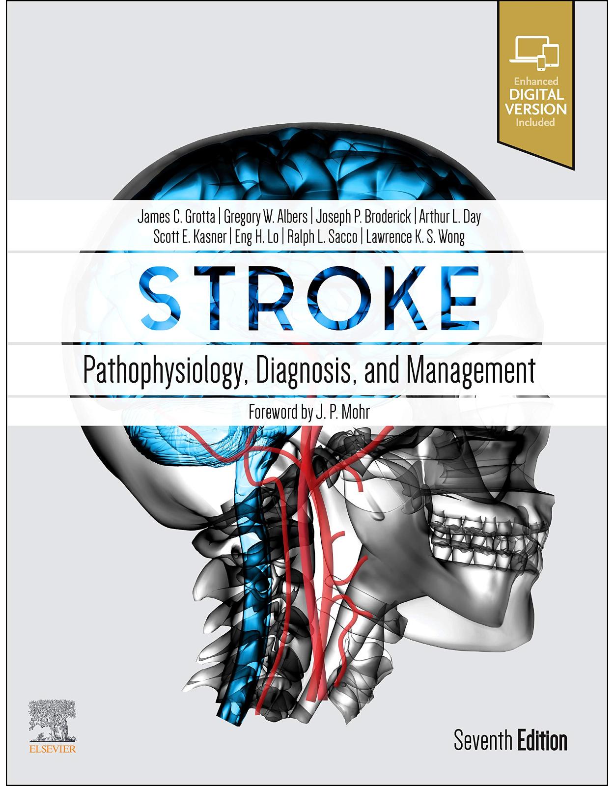 Stroke: Pathophysiology, Diagnosis, and Management