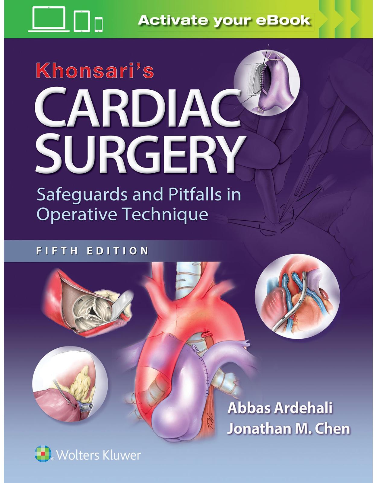 Khonsari’s Cardiac Surgery: Safeguards and Pitfalls in Operative Technique 