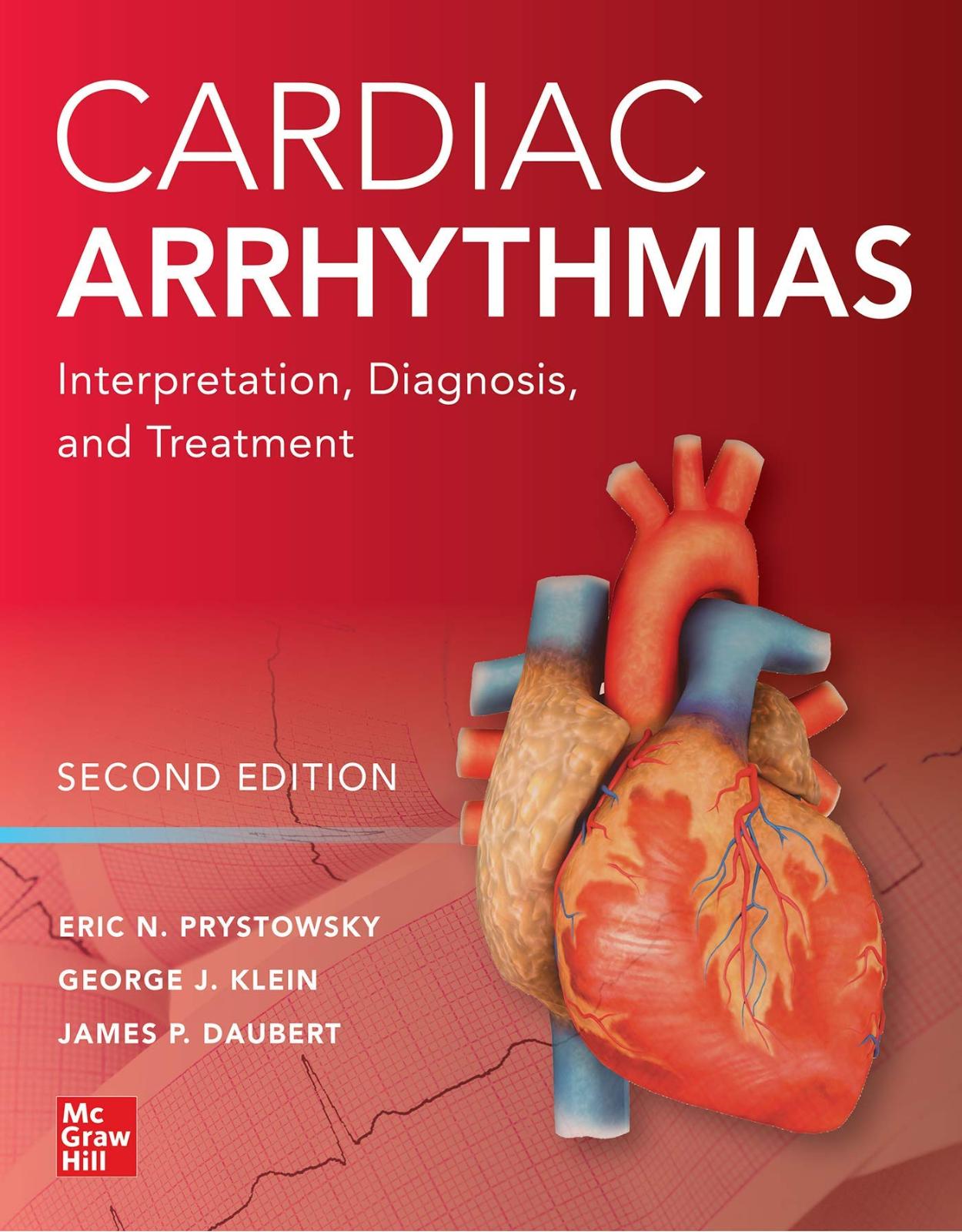 Cardiac Arrhythmias: Interpretation, Diagnosis and Treatment