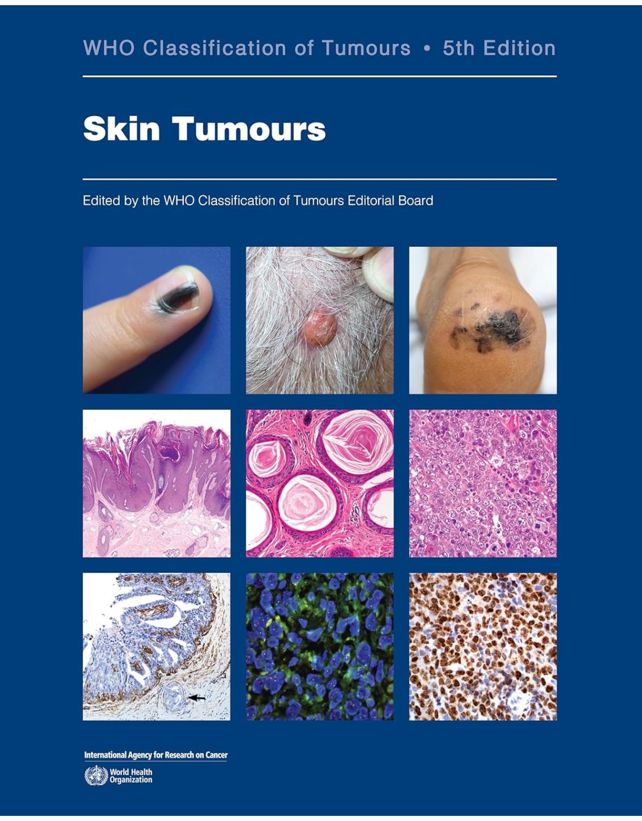 WHO Classification of Tumours. Skin Tumours, 5th edition