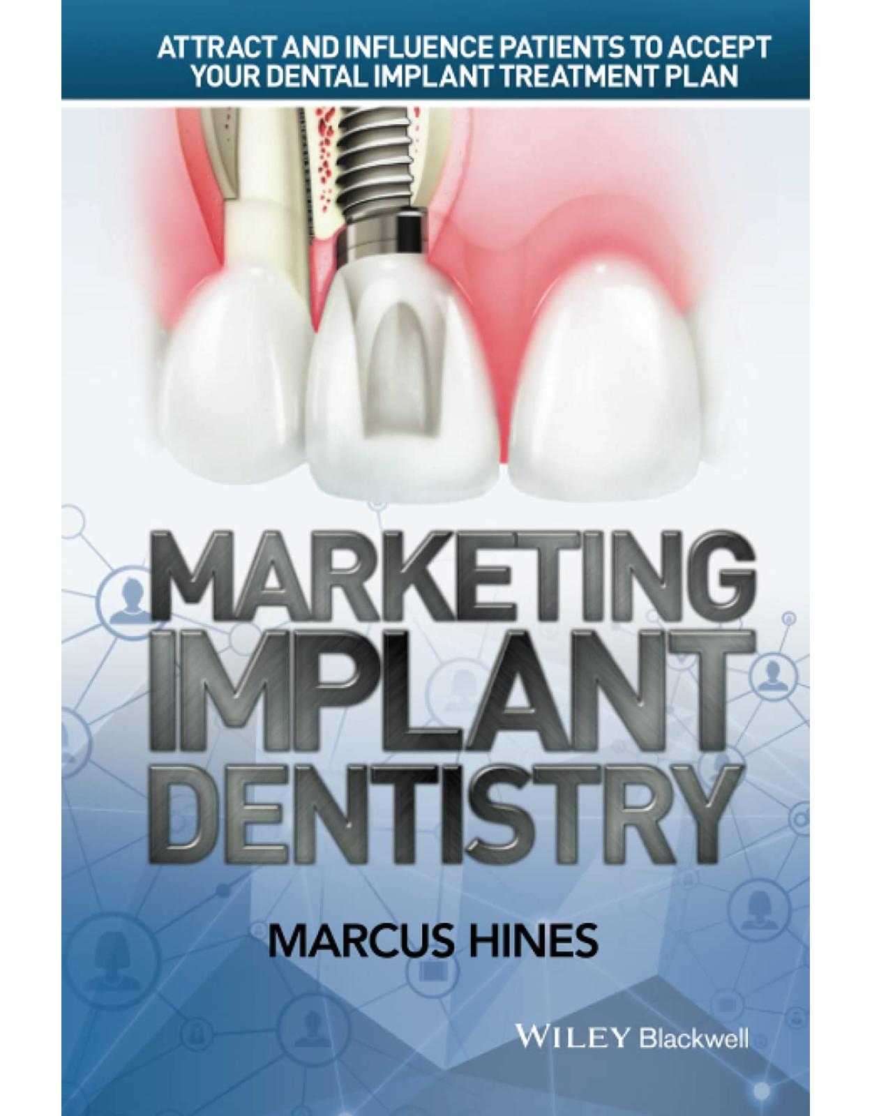 Marketing Implant Dentistry