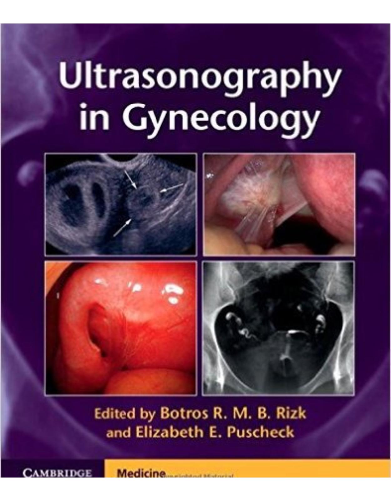 Ultrasonography in Gynecology