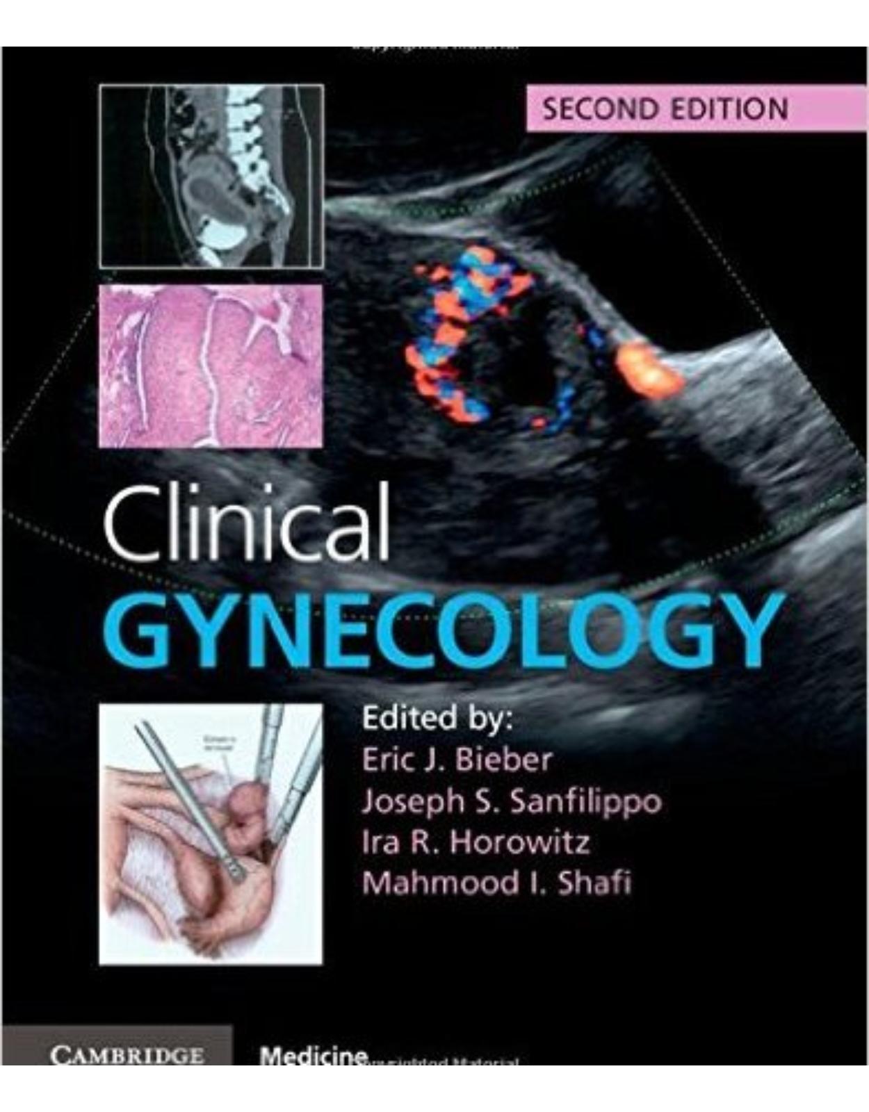 Clinical Gynecology 2nd Edition