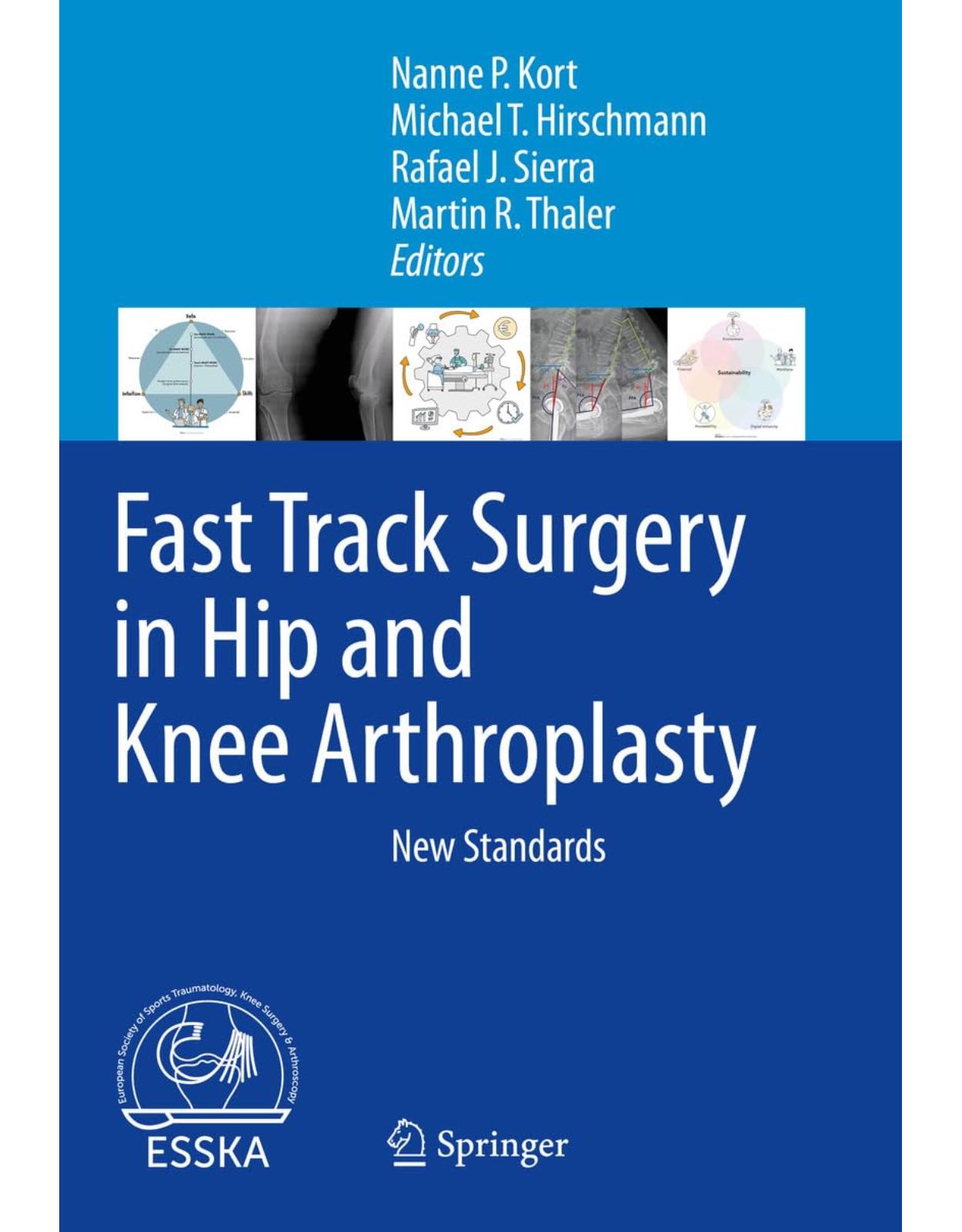 Fast Track Surgery in Hip and Knee Arthroplasty. New Standards