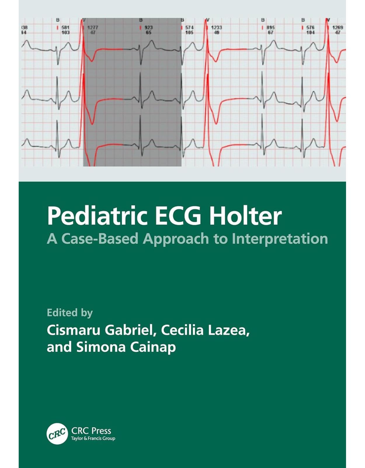 Pediatric ECG Holter. A Case-Based Approach to Interpretation