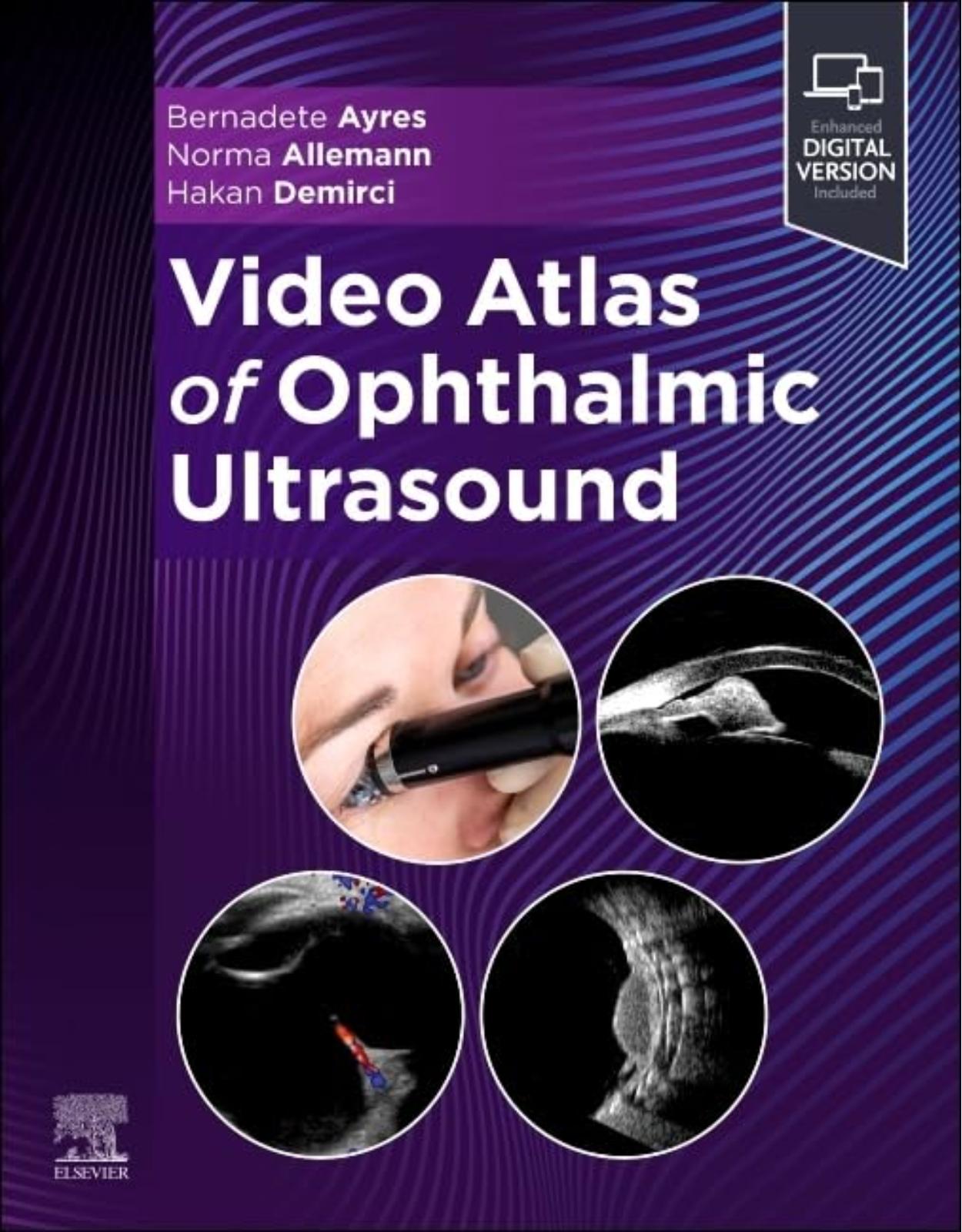 Video Atlas of Ophthalmic Ultrasound, 1st Edition