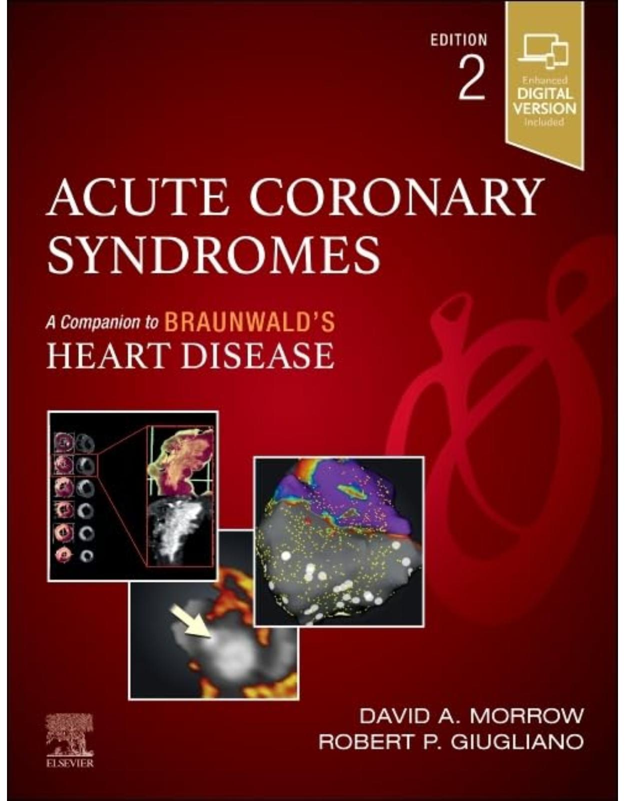 Acute Coronary Syndromes, 2nd Edition