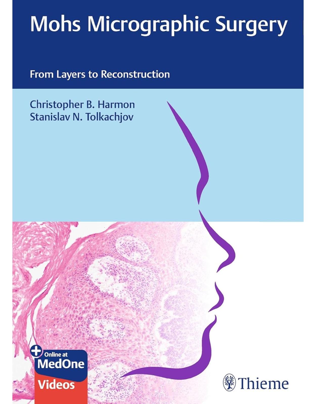 Mohs Micrographic Surgery: From Layers to Reconstruction.