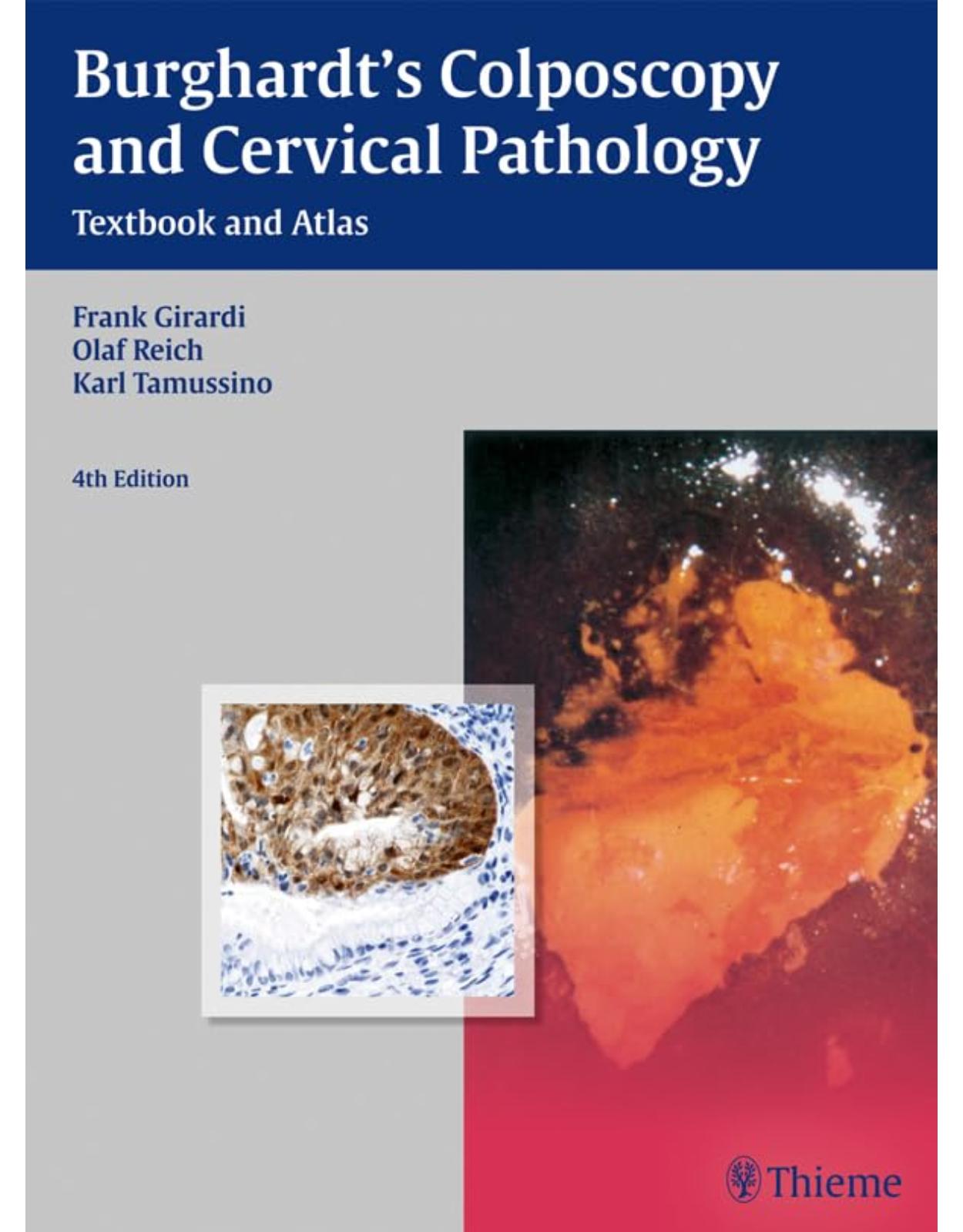 Burghardts Colposcopy and Cervical Pathology: Textbook and Atlas 4th edition 