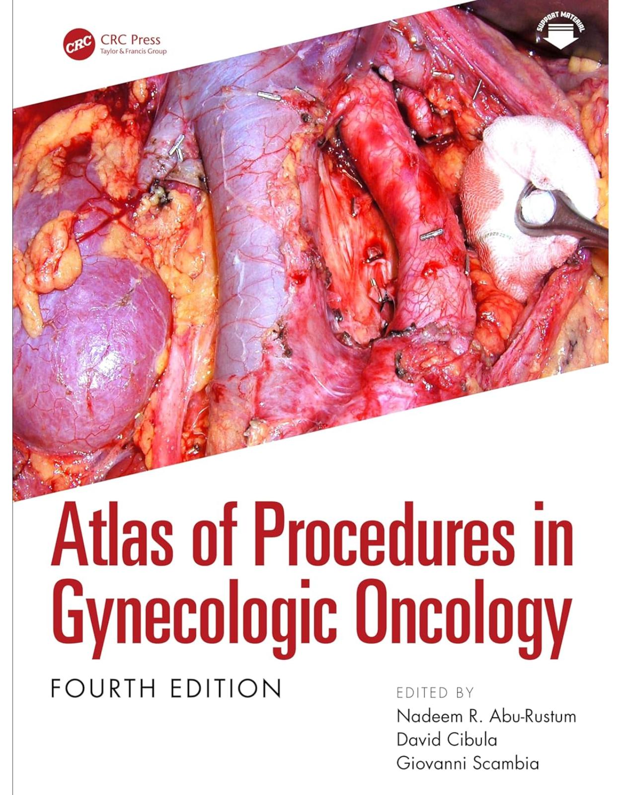 Atlas of Procedures in Gynecologic Oncology