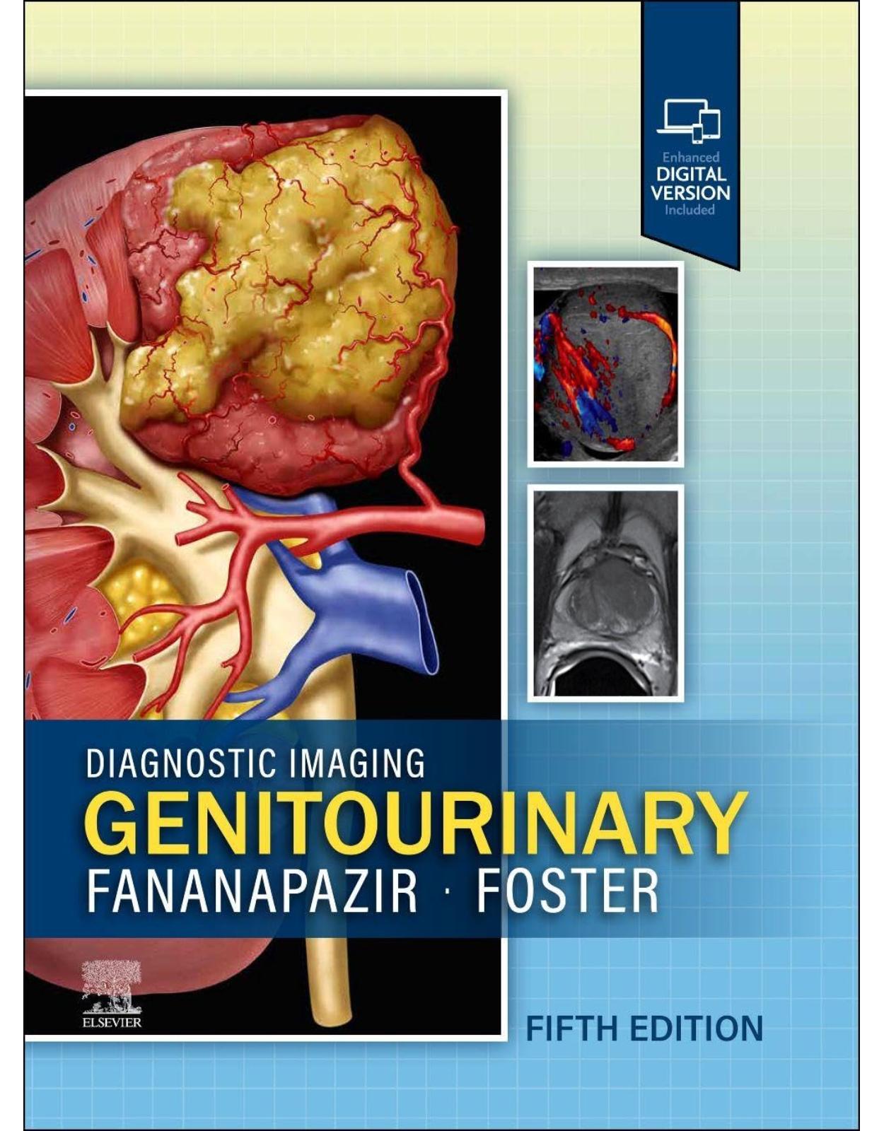 Diagnostic Imaging: Genitourinary, 5th Edition