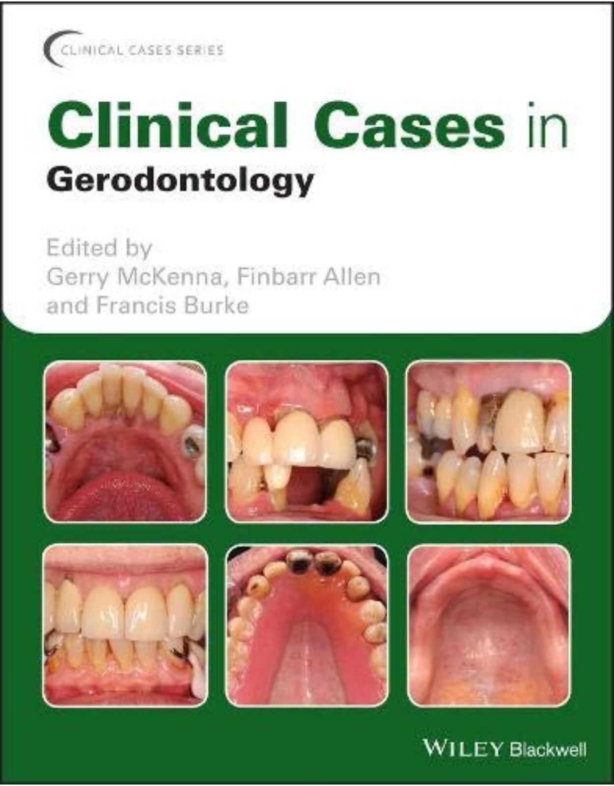 Clinical Cases in Gerodontology (Clinical Cases (Dentistry))