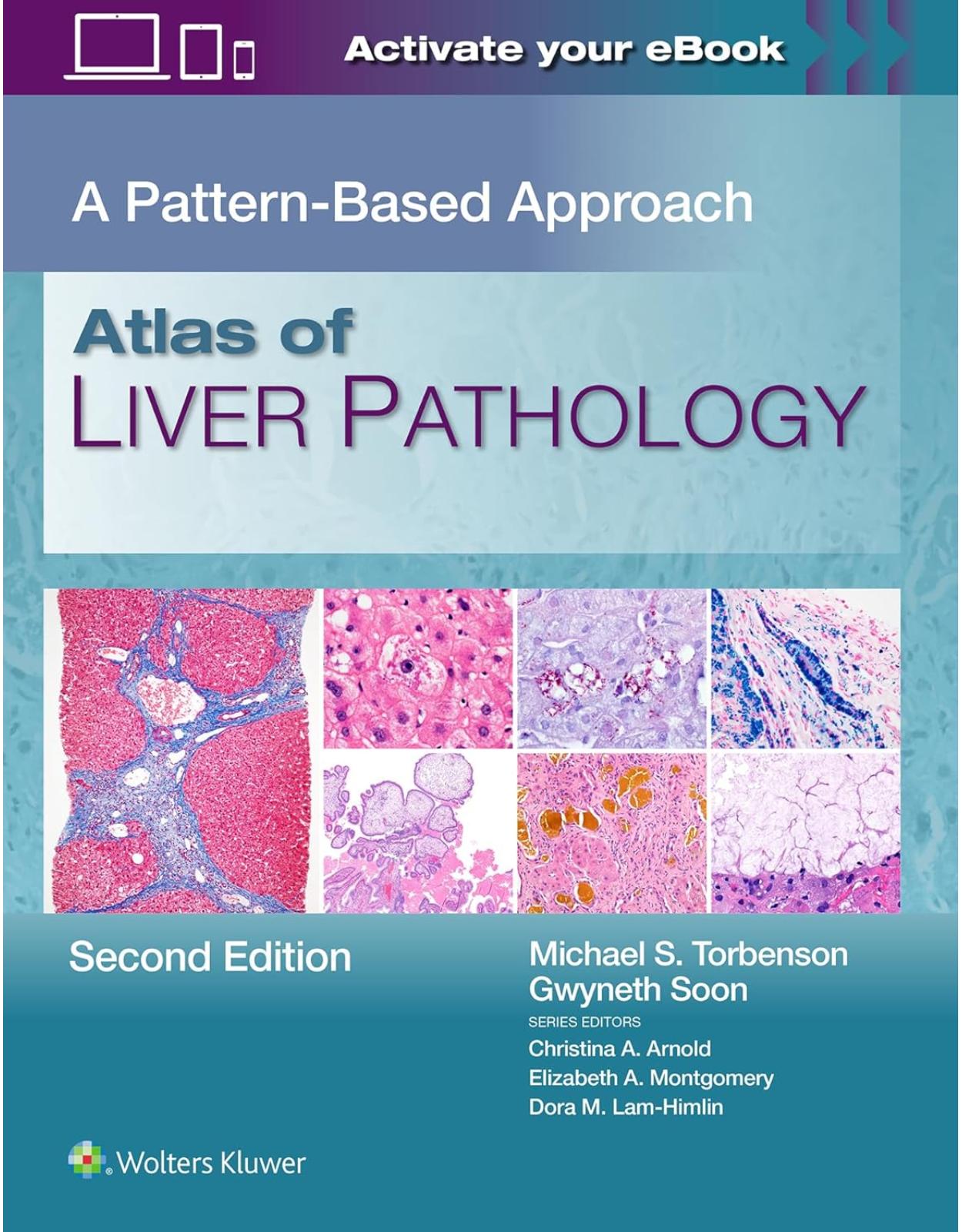 Atlas of Liver Pathology. A Pattern-Based Approach, Second edition