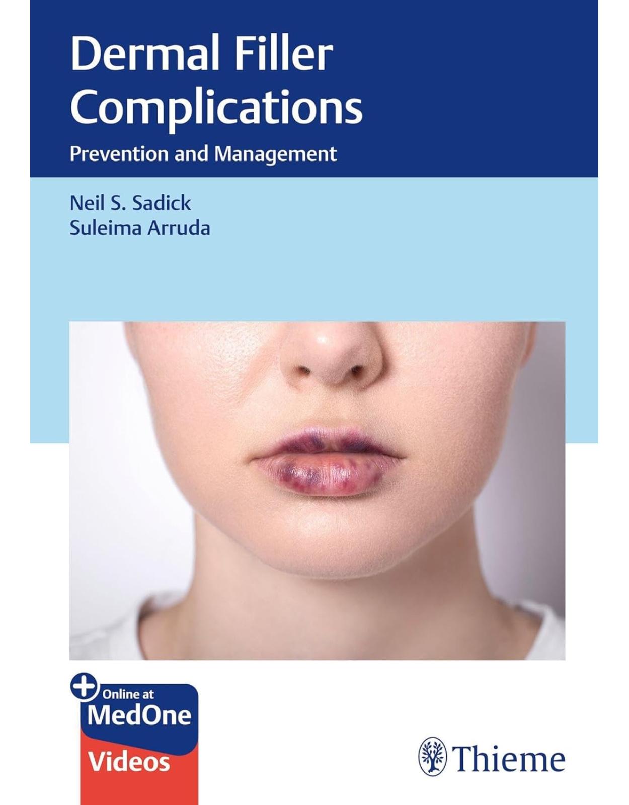 Dermal Filler Complications. Prevention and Management