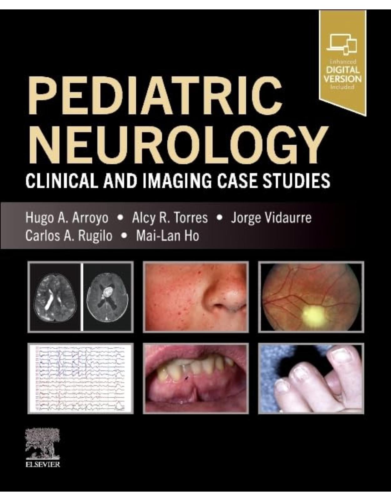 Pediatric Neurology
