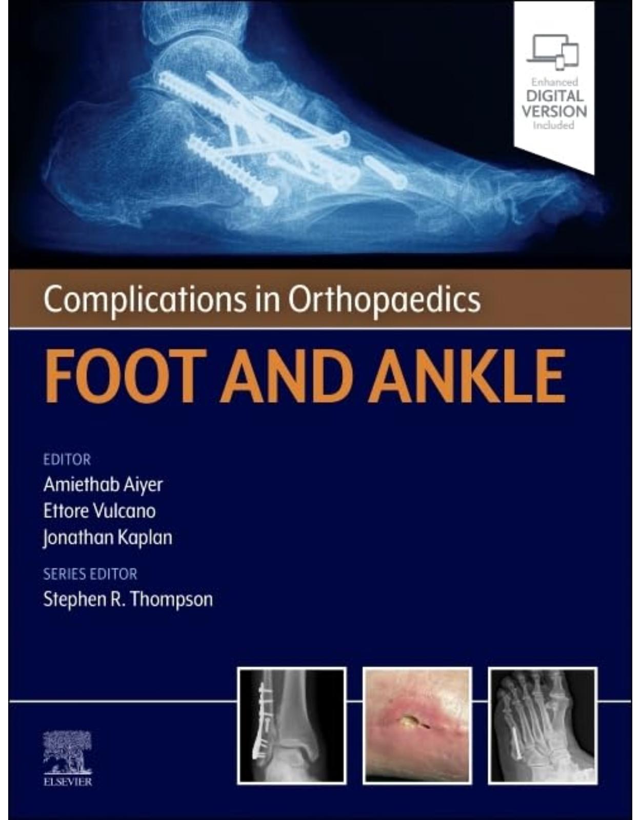 Complications in Orthopaedics: Foot and Ankle