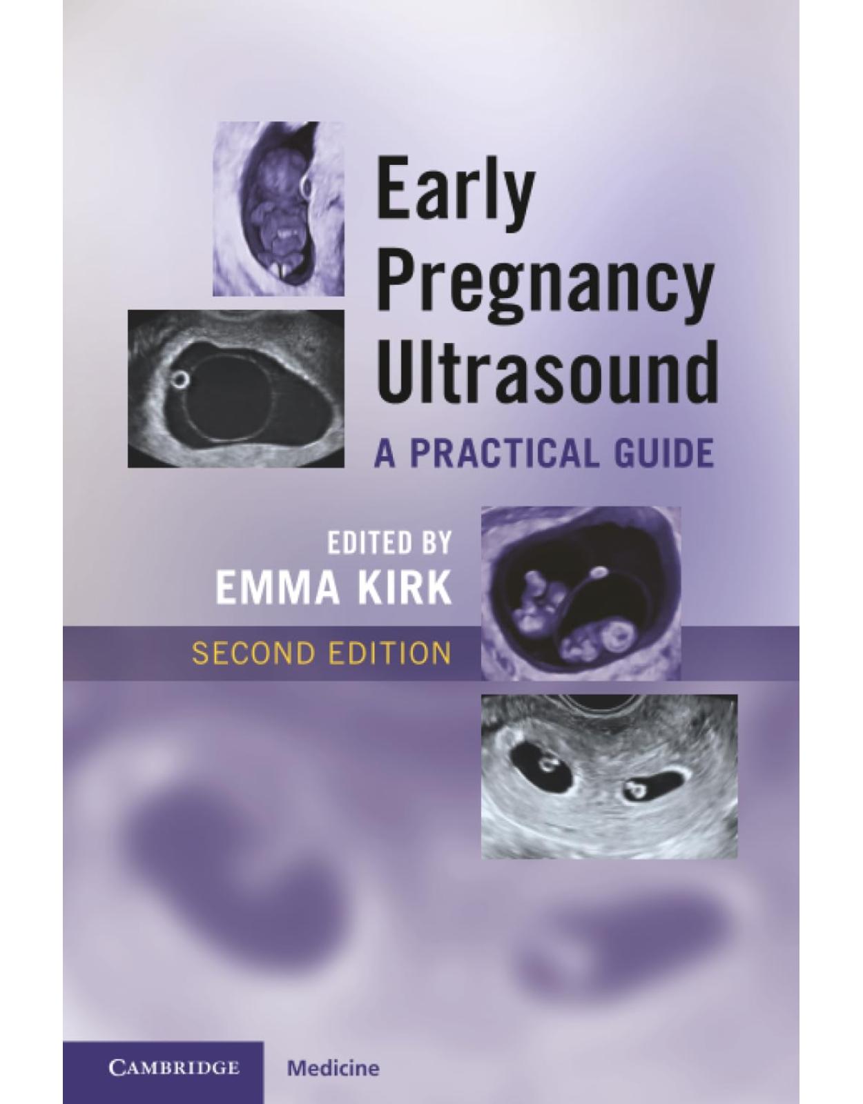 Early Pregnancy Ultrasound