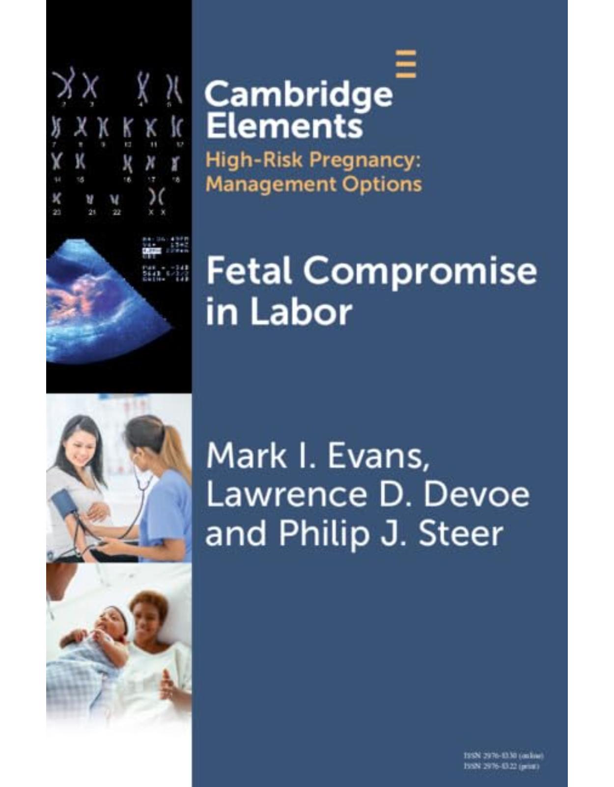  Fetal Compromise in Labor 