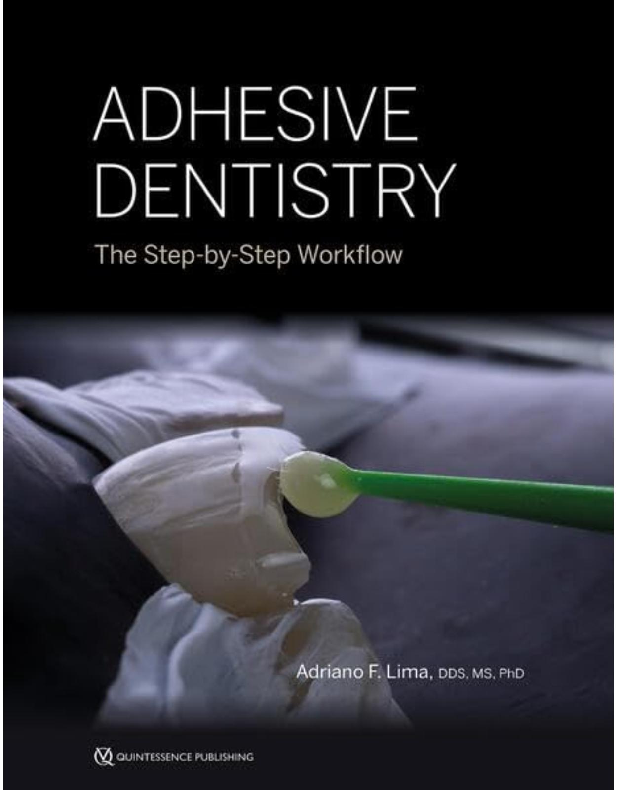 Adhesive Dentistry. The Step-by-Step Workflow
