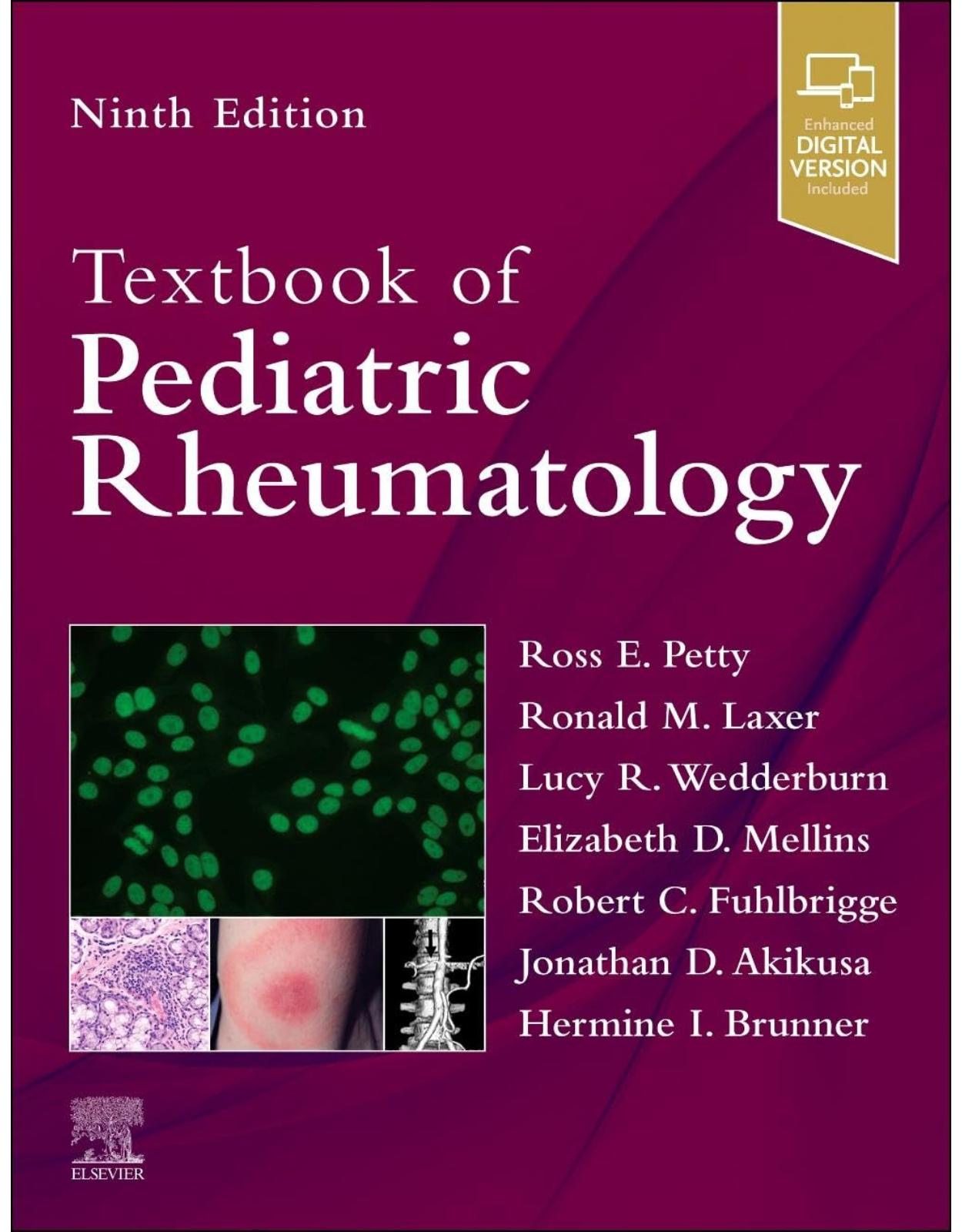 Textbook of Pediatric Rheumatology, 9th Edition