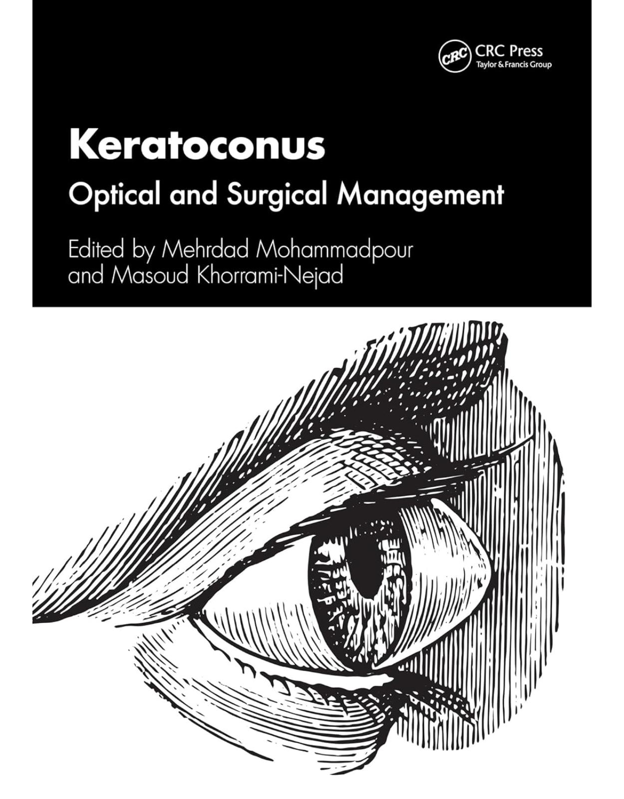 Keratoconus Optical and Surgical Management