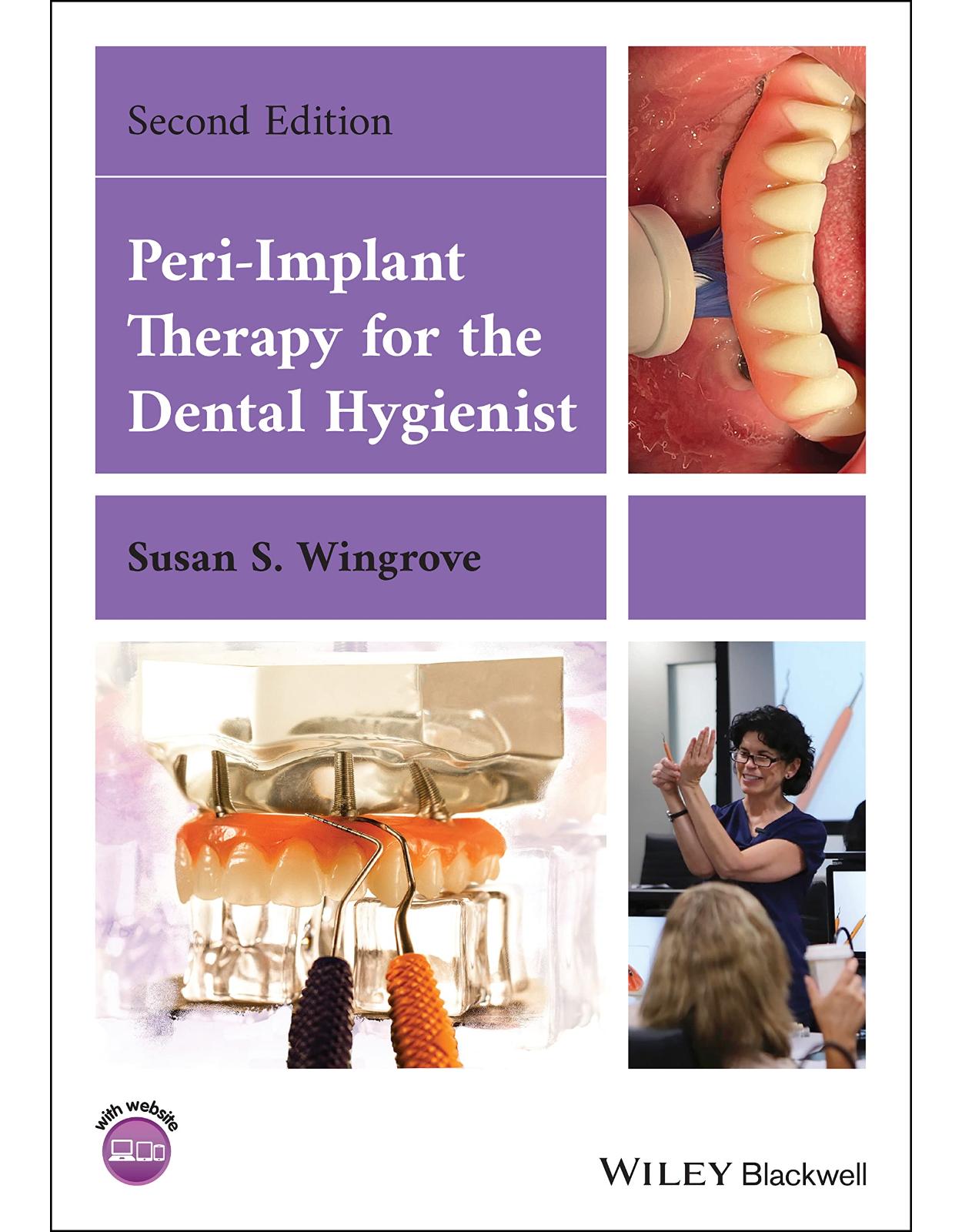 Peri–Implant Therapy for the Dental Hygienist