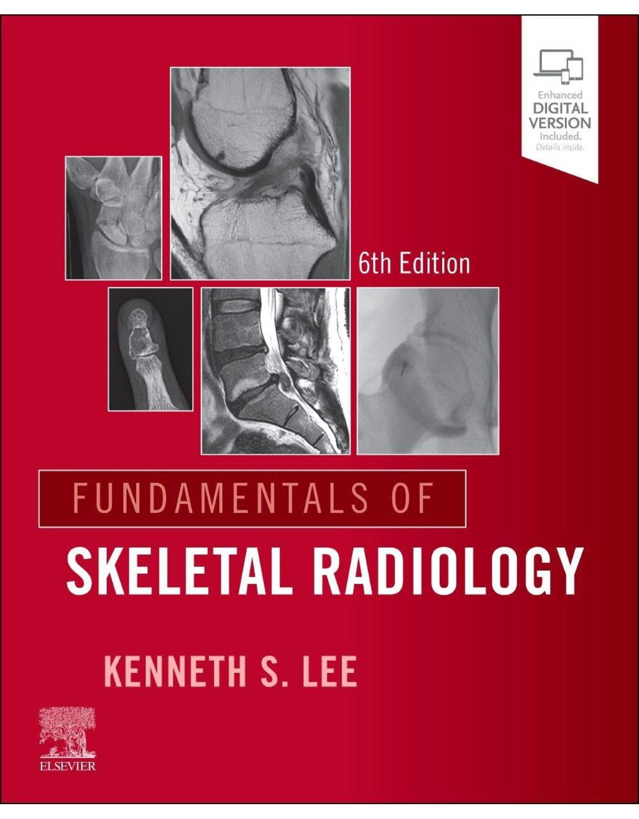 Fundamentals of Skeletal Radiology, 6th Edition