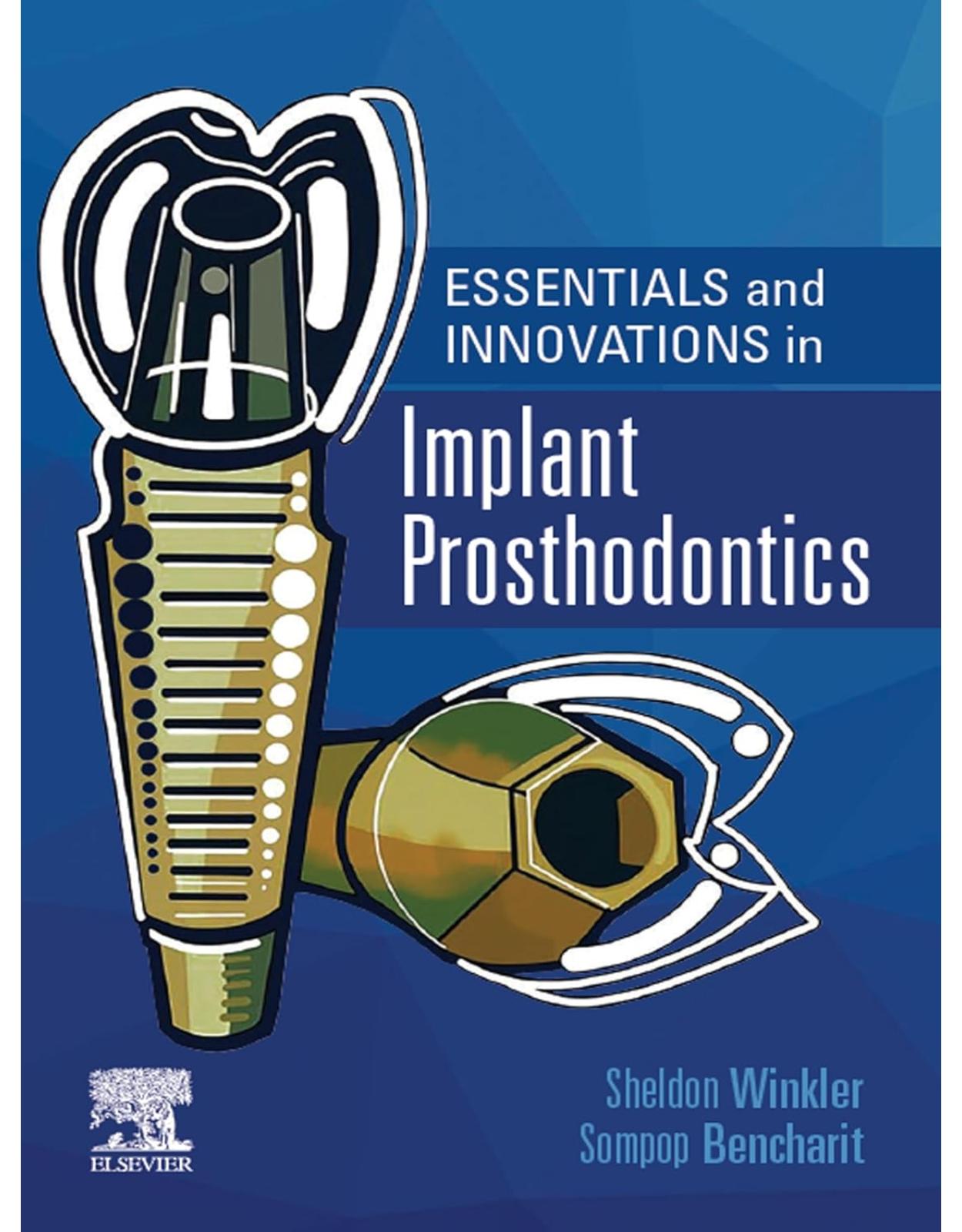 Essentials and Innovations in Implant Prosthodontics, 1st Edition