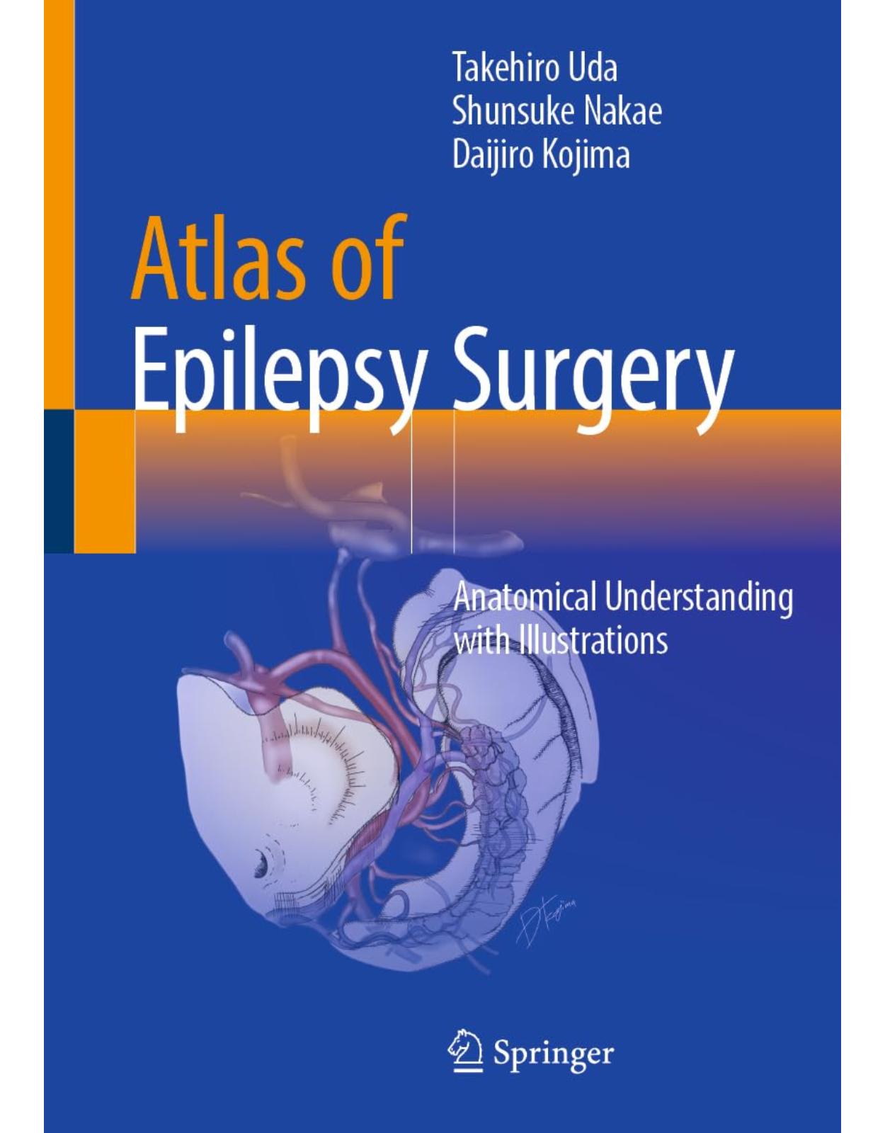 Atlas of Epilepsy Surgery: Anatomical Understanding with Illustrations