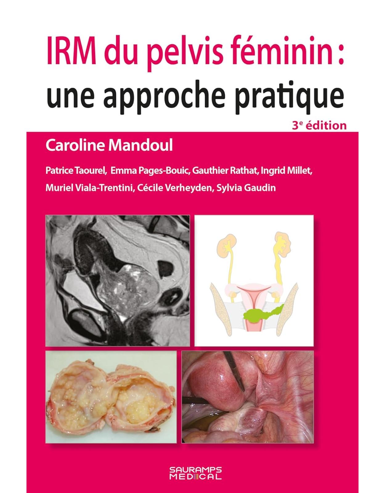 IRM du pelvis féminin: une approche pratique 3e ed