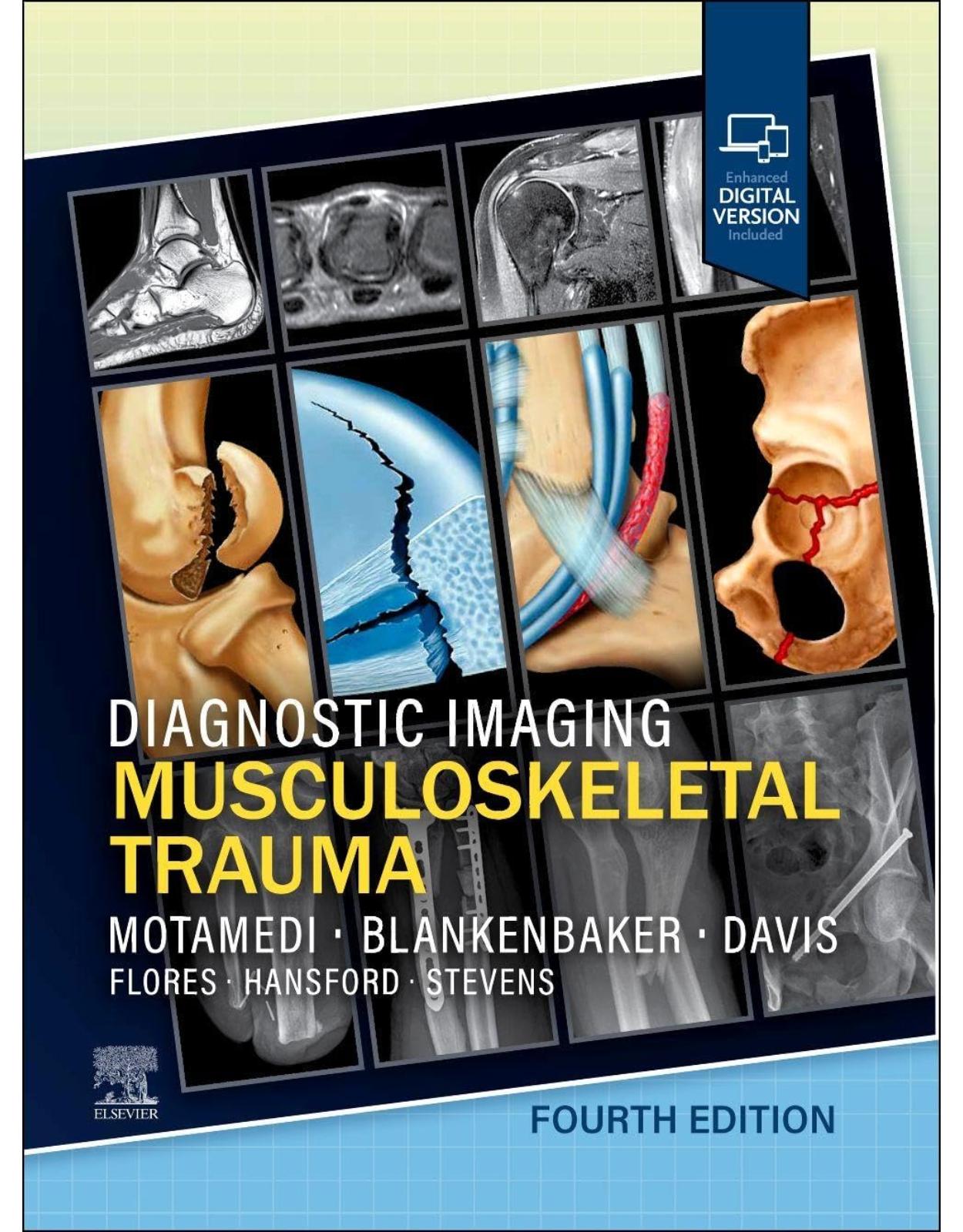 Diagnostic Imaging: Musculoskeletal Trauma