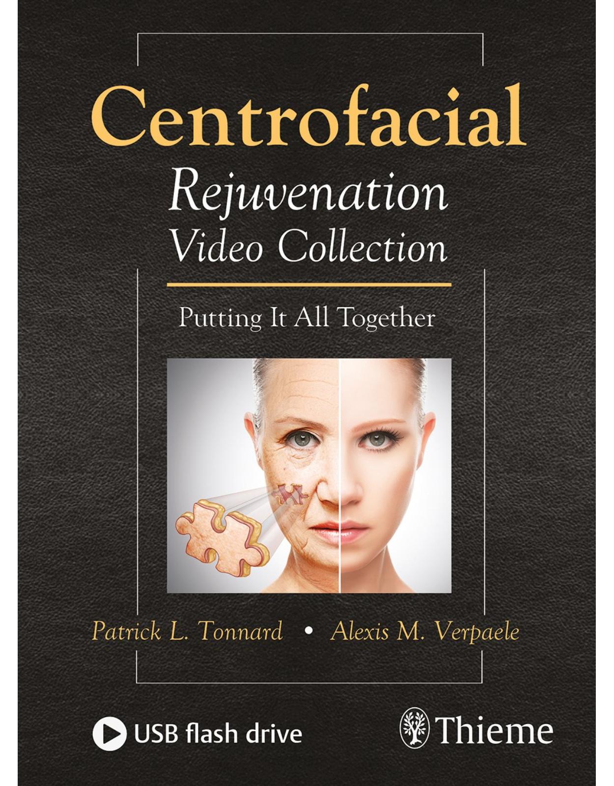 Centrofacial Rejuvenation Video Collection: Putting It All Together