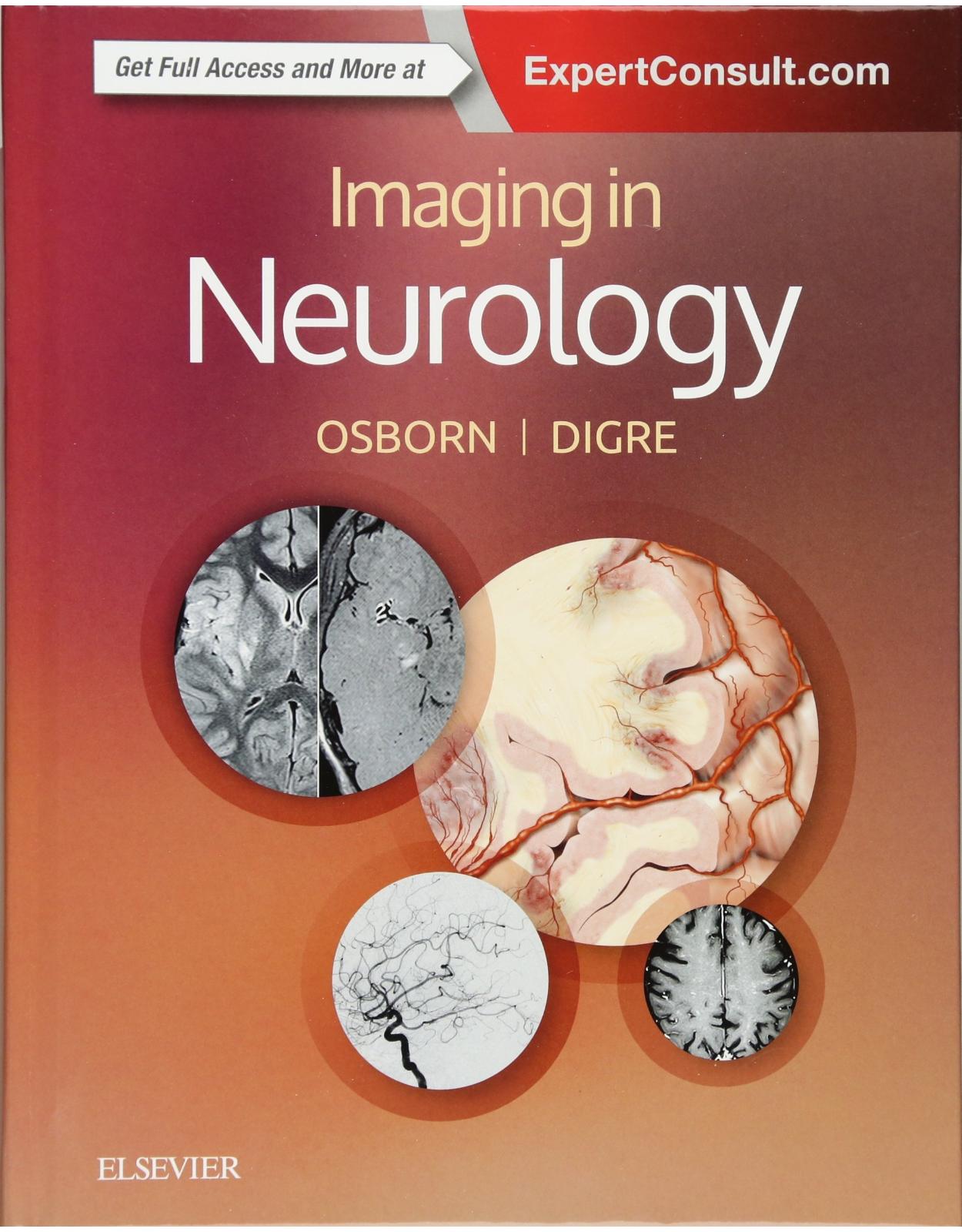 Imaging in Neurology