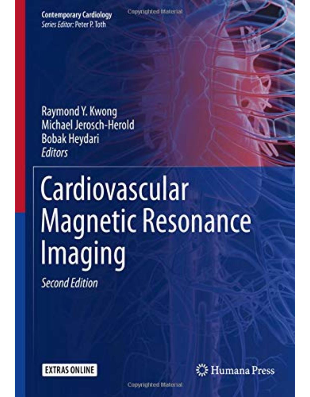 Cardiovascular Magnetic Resonance Imaging