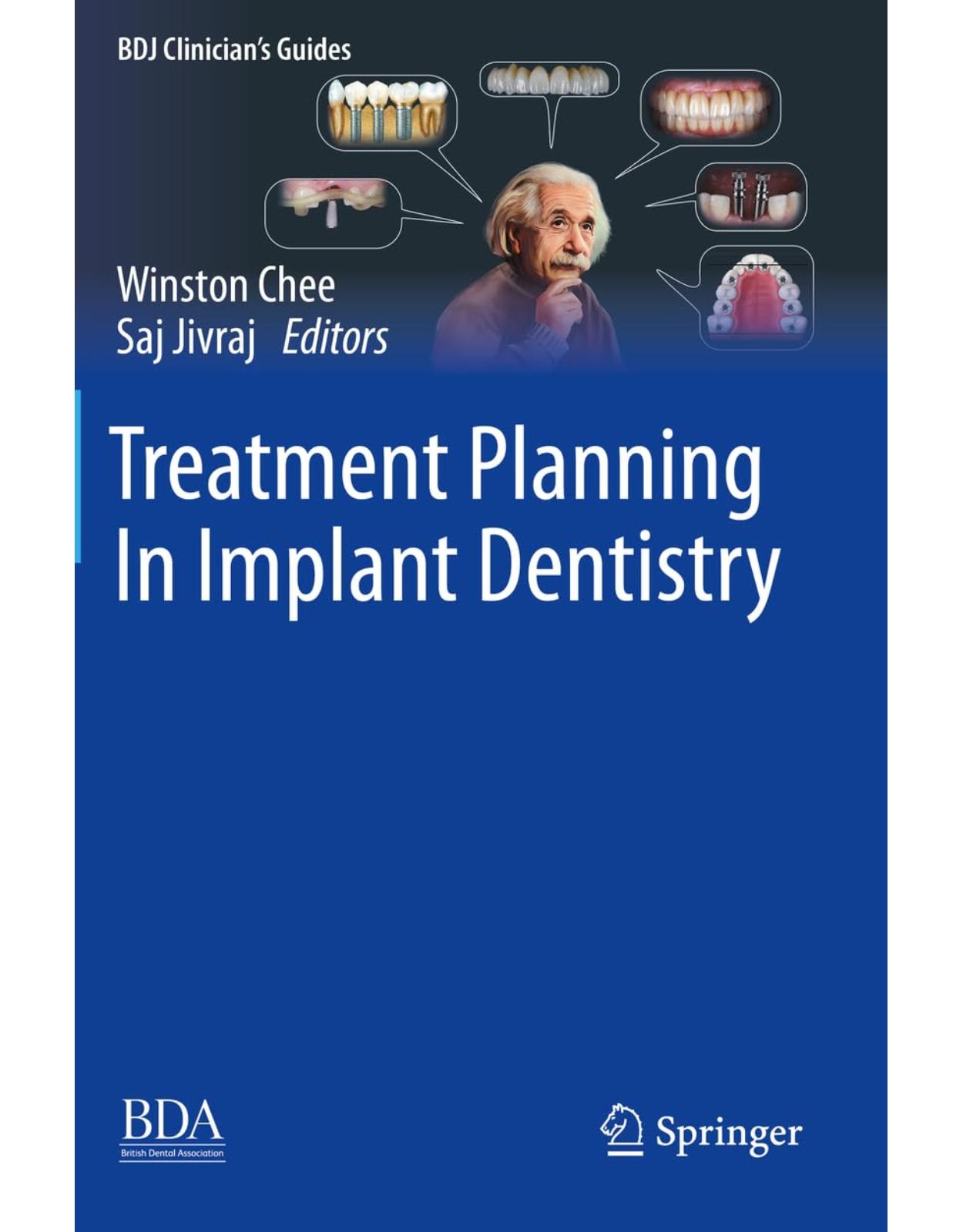 Treatment Planning In Implant Dentistry (BDJ Clinicians Guides)