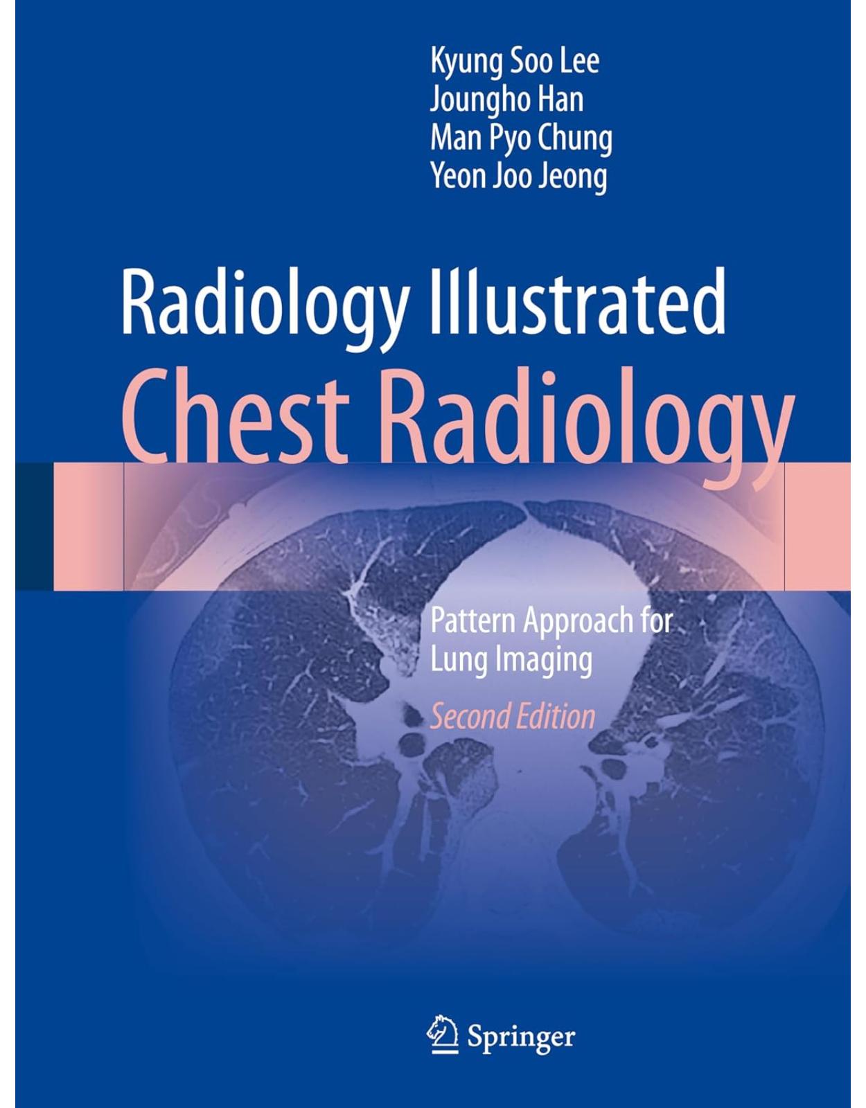 Radiology Illustrated: Chest Radiology: Pattern Approach for Lung Imaging