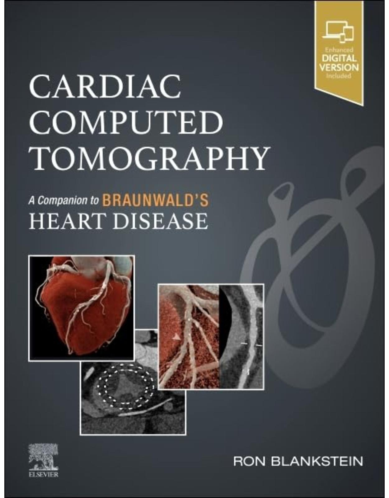 Cardiac Computed Tomography: A Companion to Braunwald's Heart Disease
