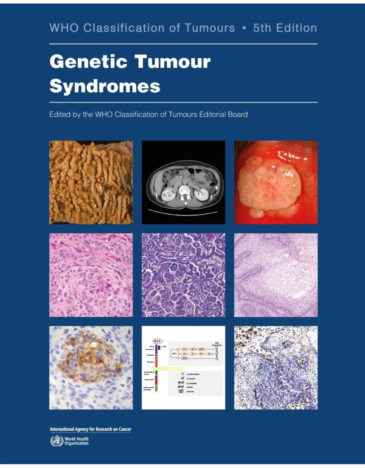 Genetic Tumour Syndromes: WHO Classification of Tumours