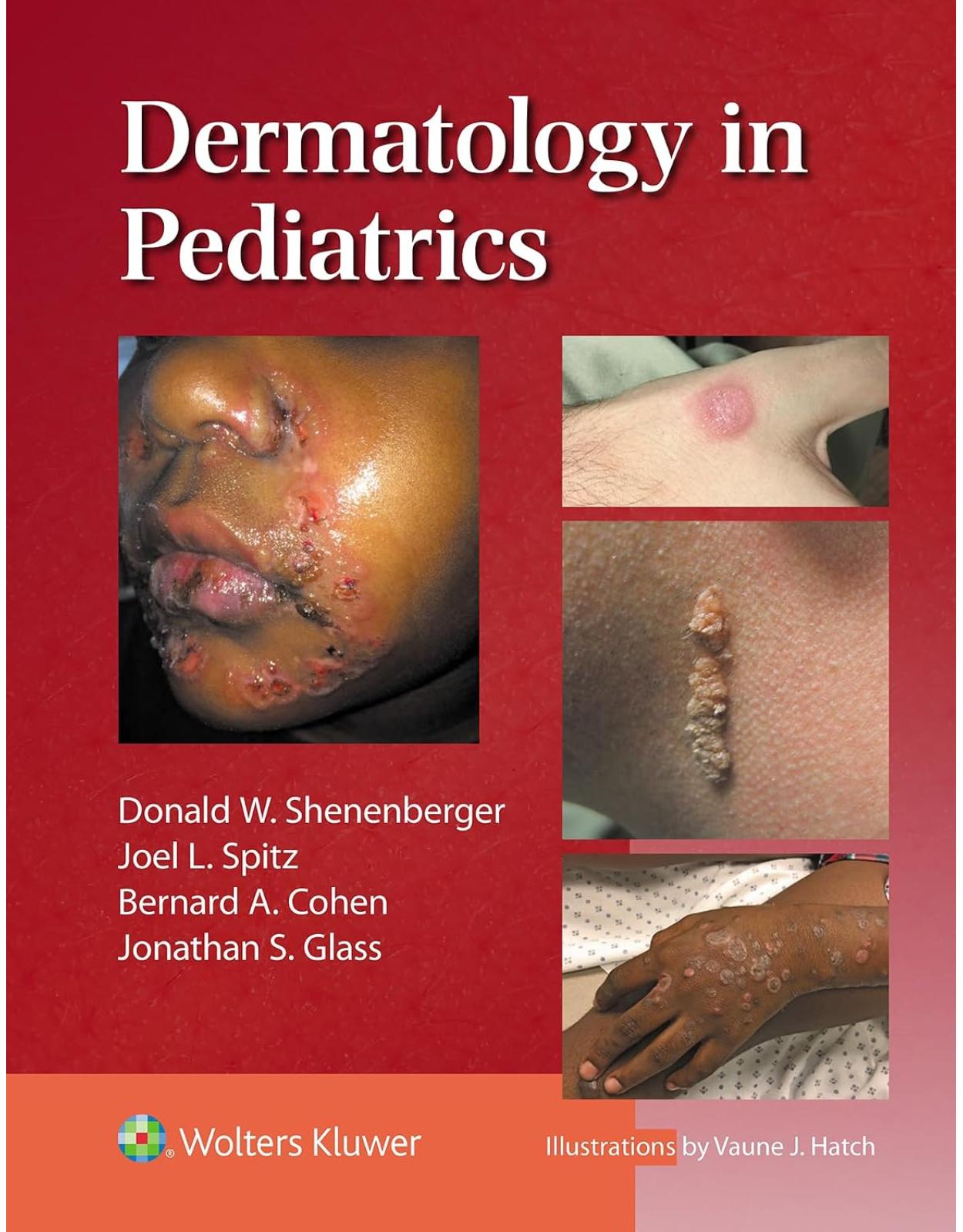 Dermatology in Pediatrics. First edition