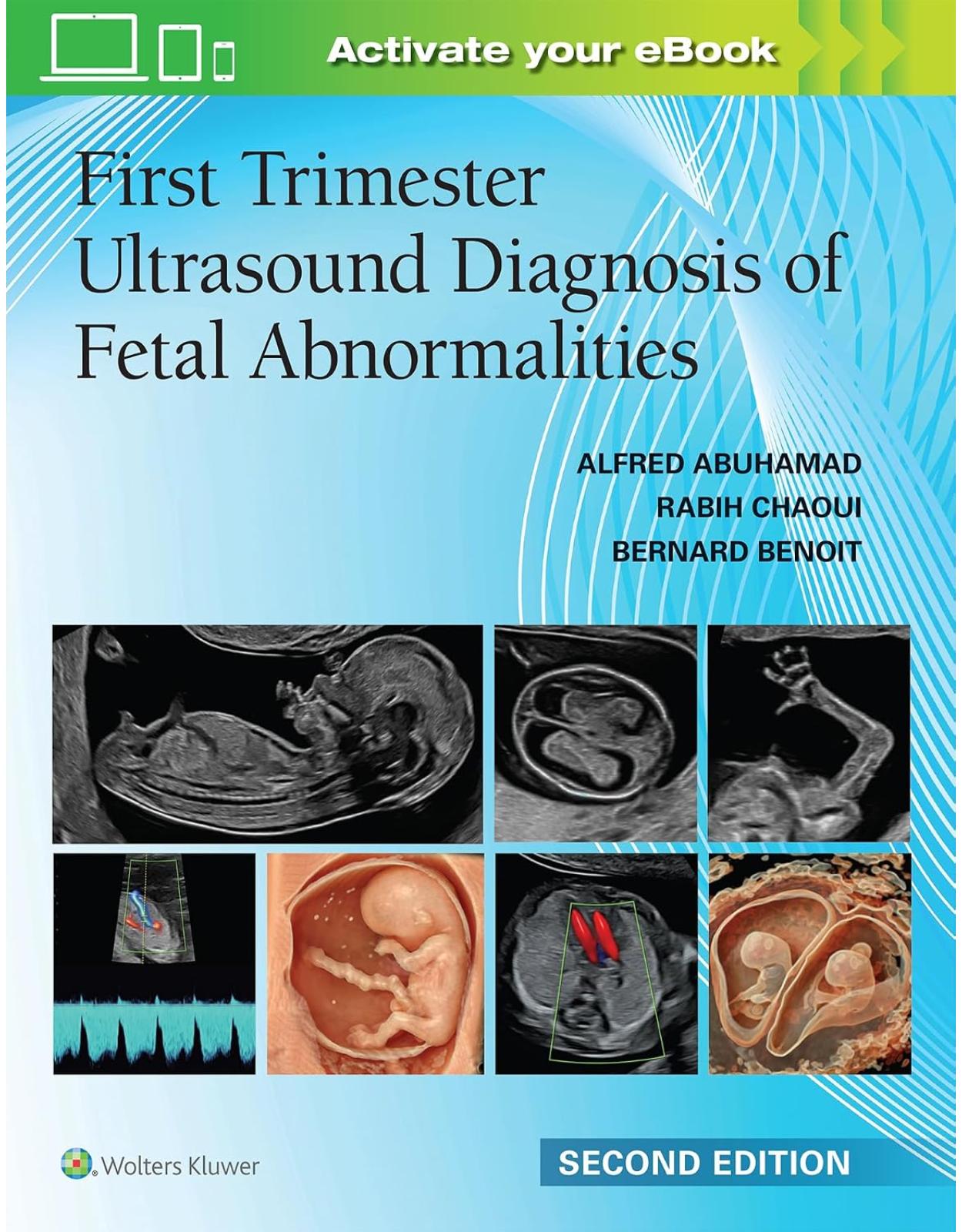 First Trimester Ultrasound Diagnosis of Fetal Abnormalities. Second edition