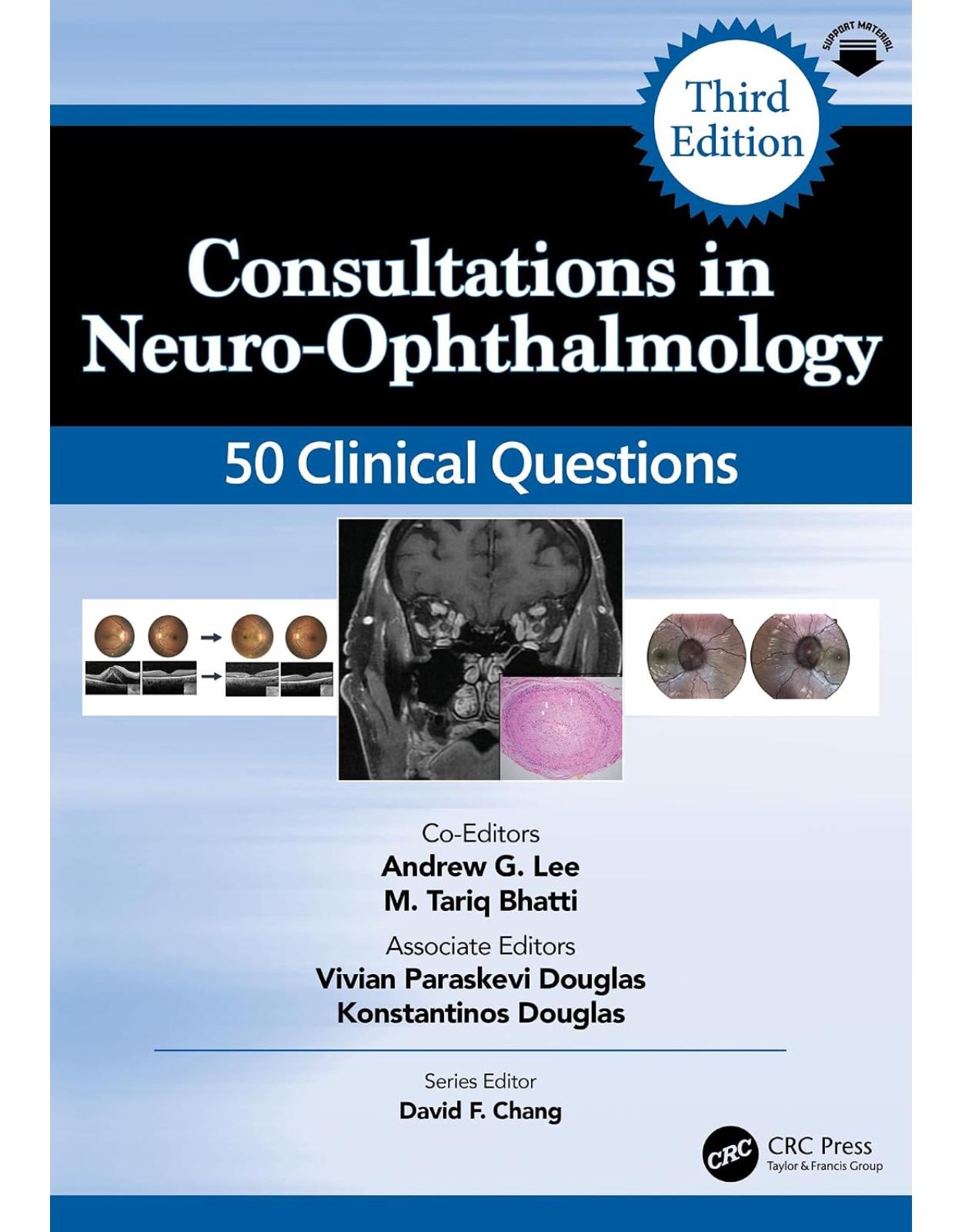 Consultations in Neuro-Ophthalmology. 50 Clinical Questions