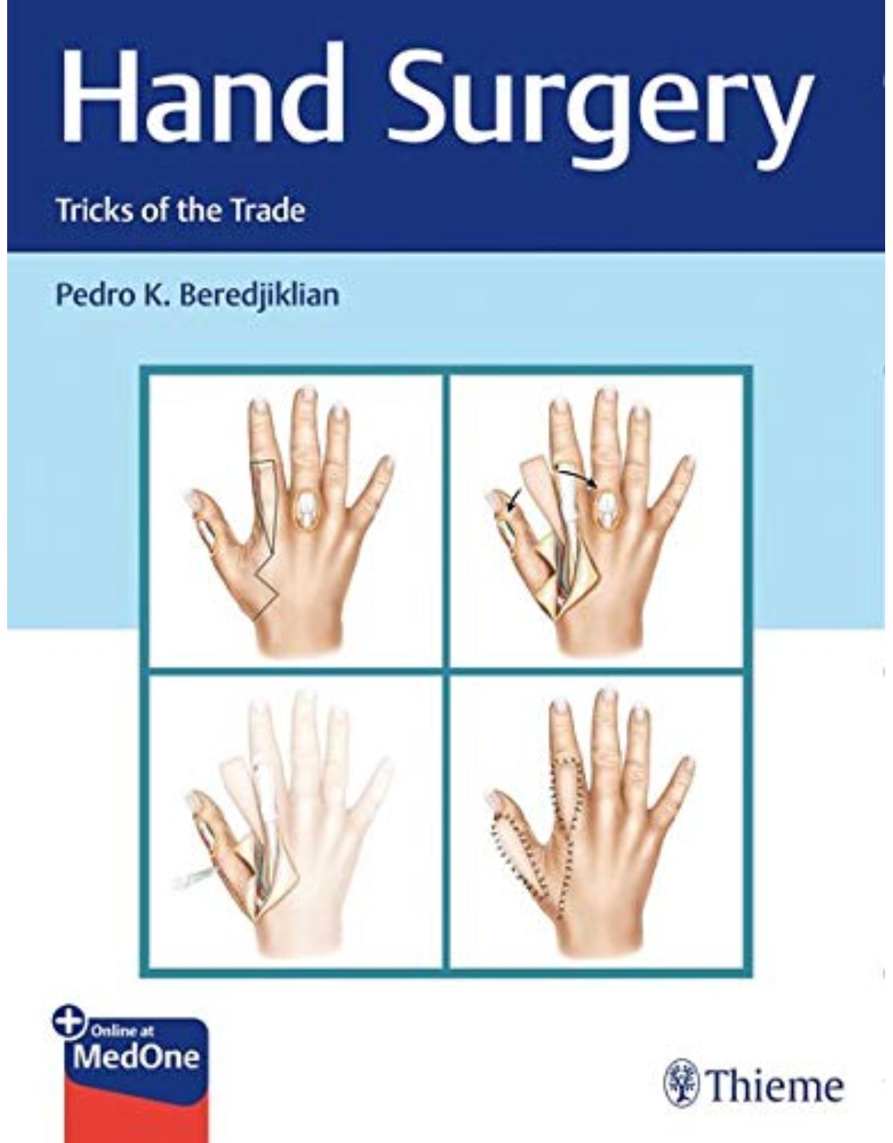 Hand Surgery: Tricks of the Trade
