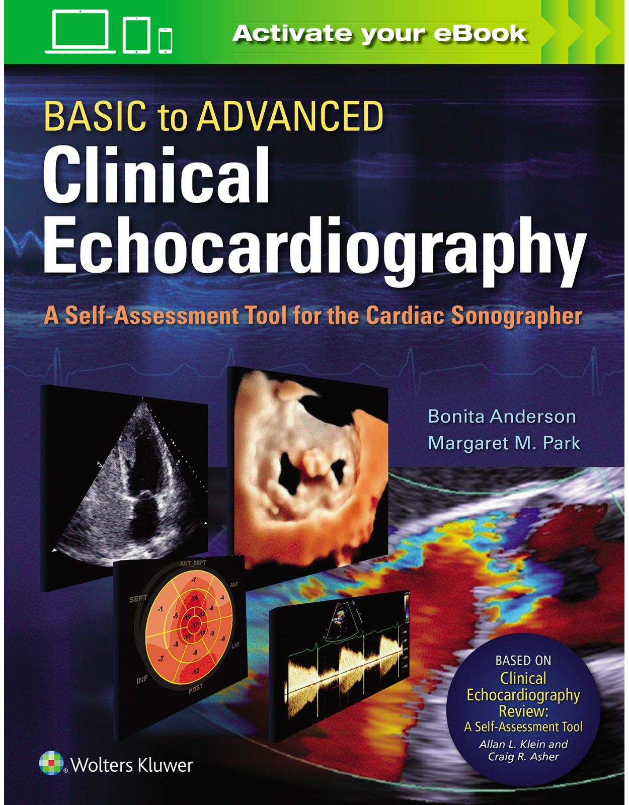 Basic to Advanced Clinical Echocardiography:A Self-Assessment Tool for the Cardiac Sonographer 